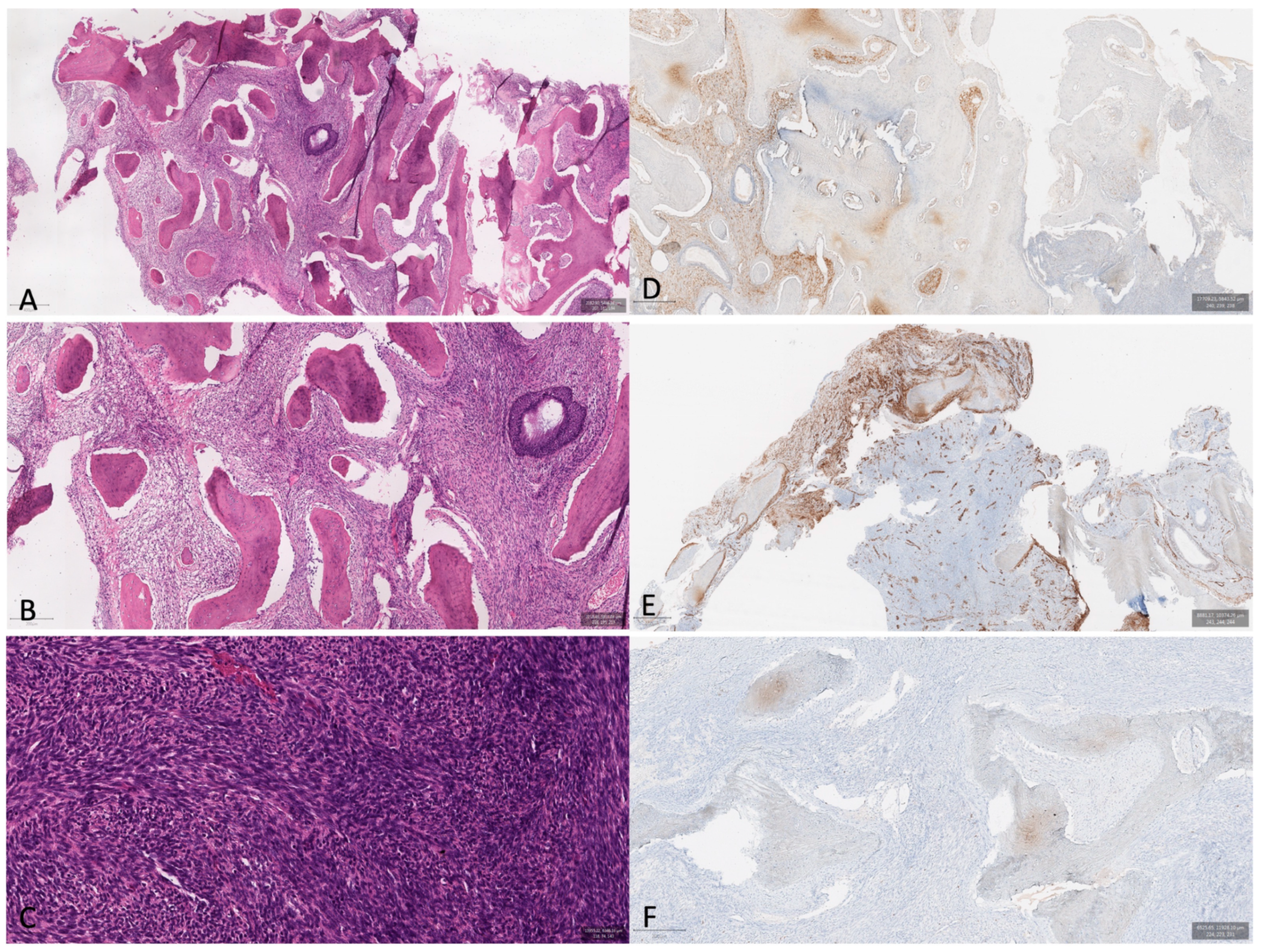 Cancers 16 03316 g003