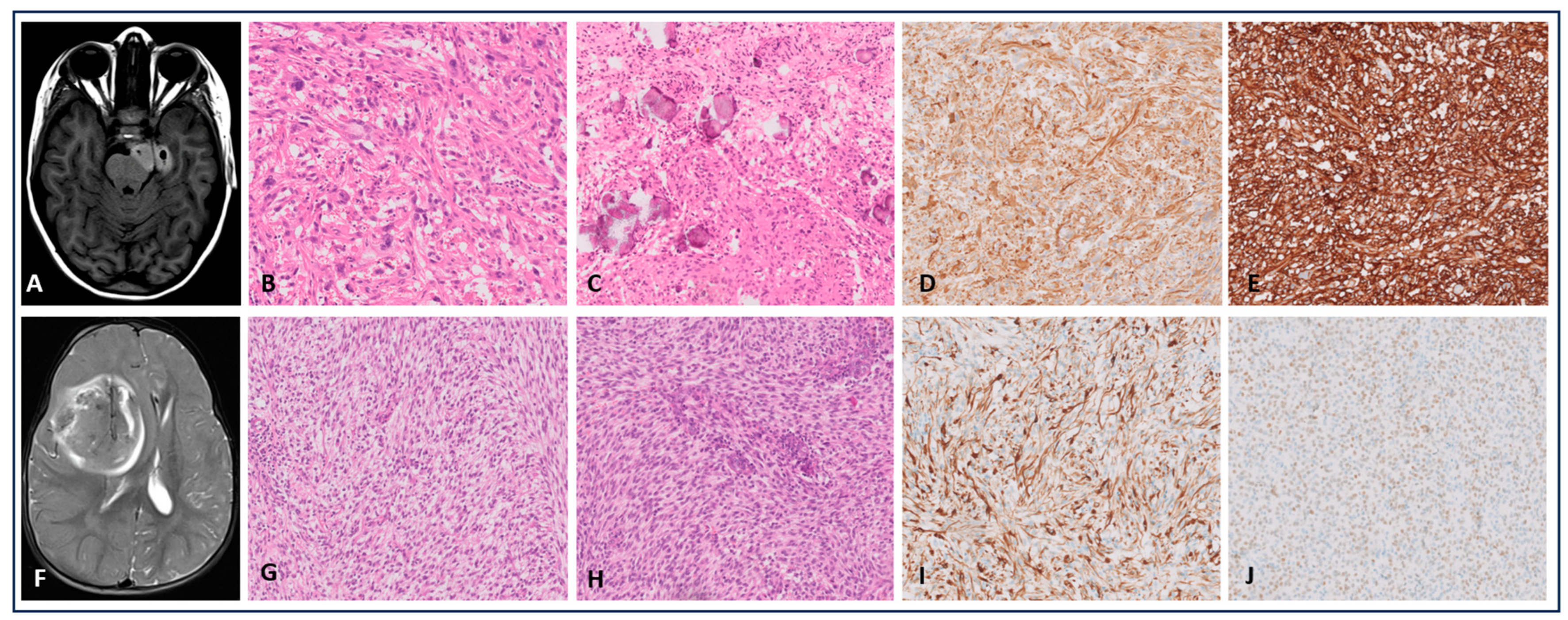 Cancers 16 03344 g001