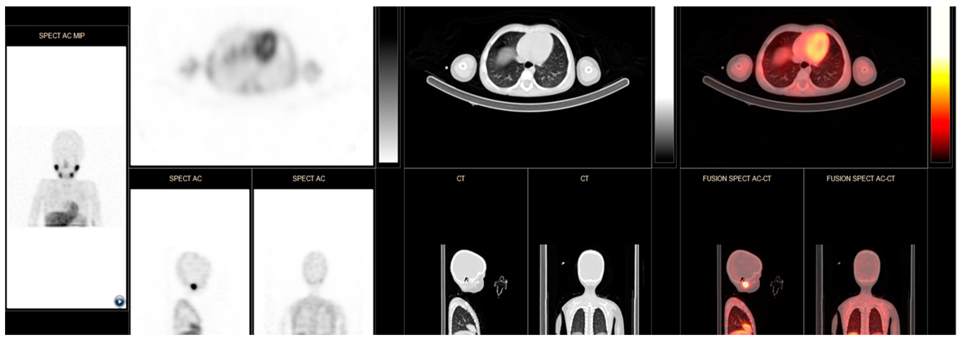 Cancers 16 03348 g003 Cancers 16 03348 g003