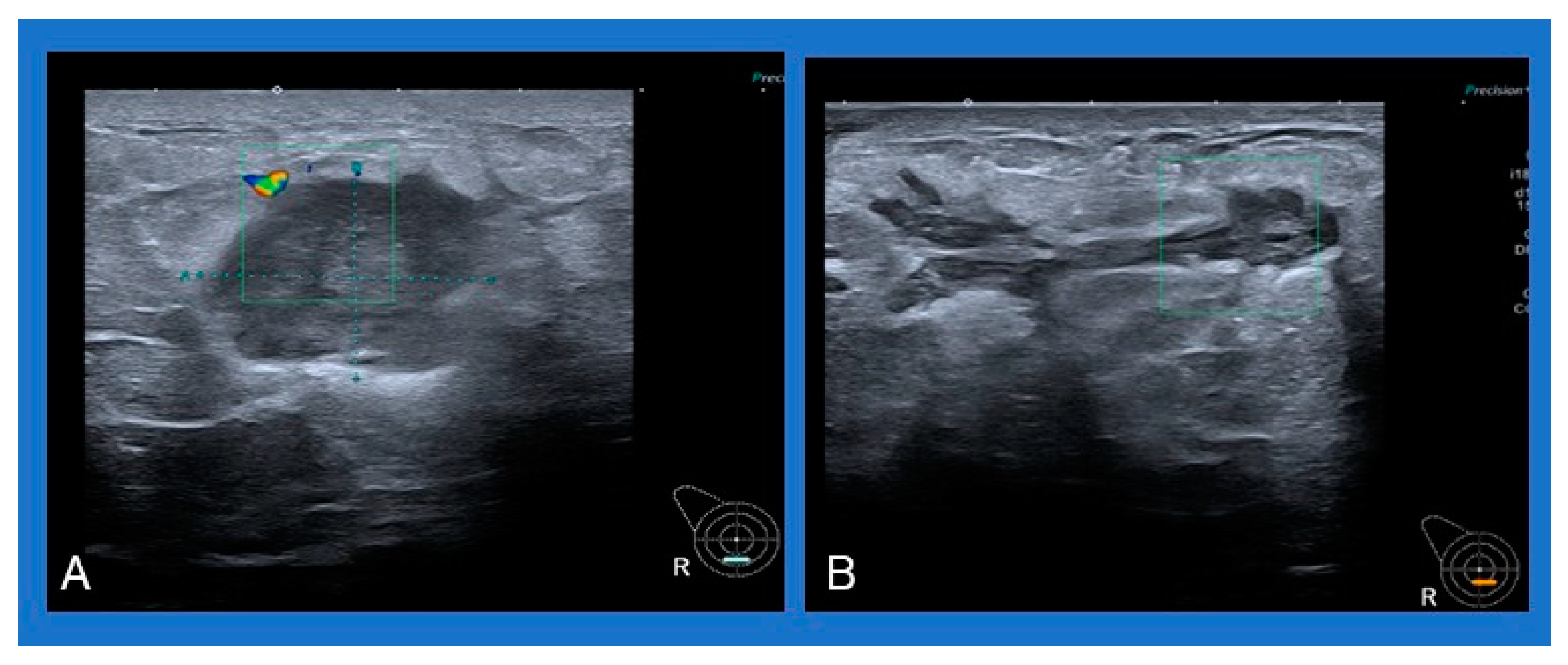 Cancers 16 03387 g002