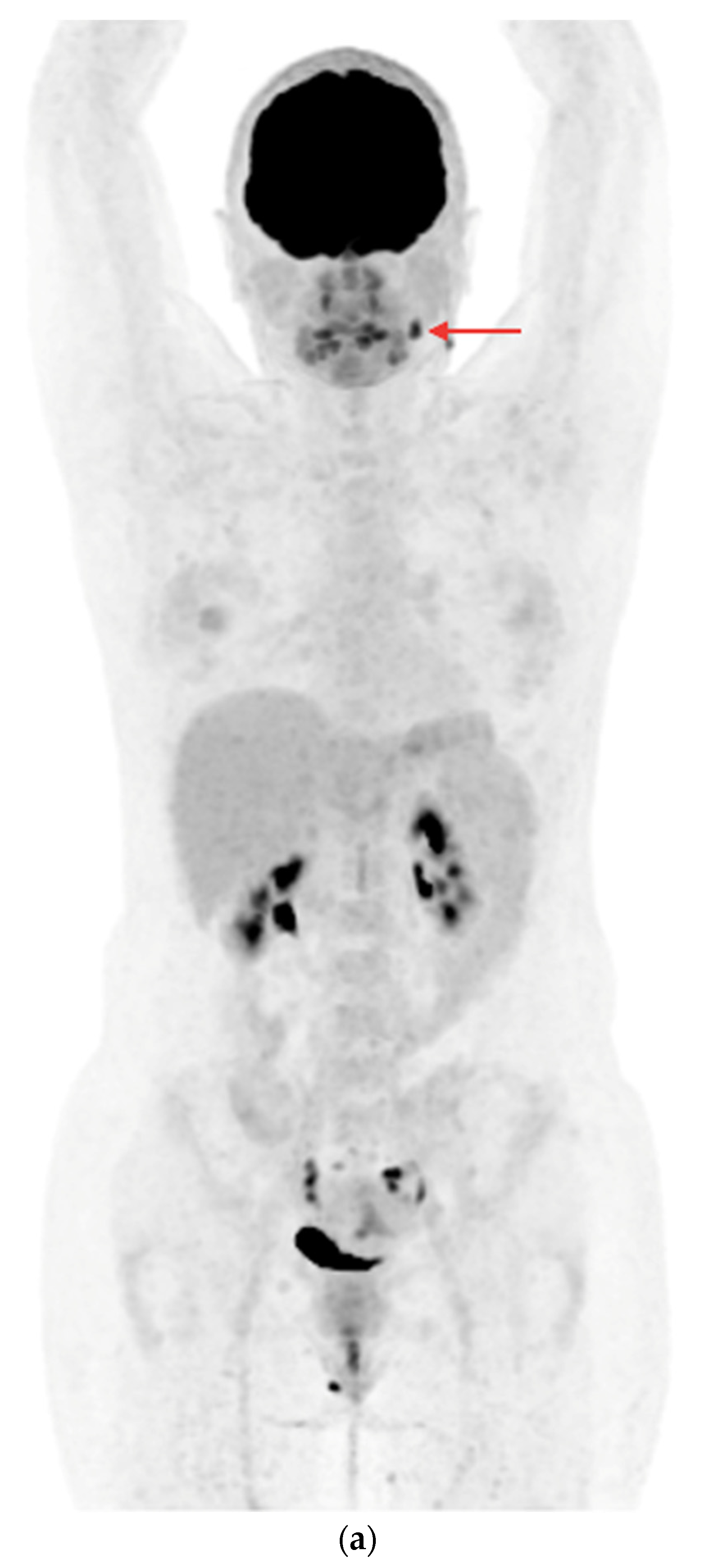 Cancers 16 03413 g003a