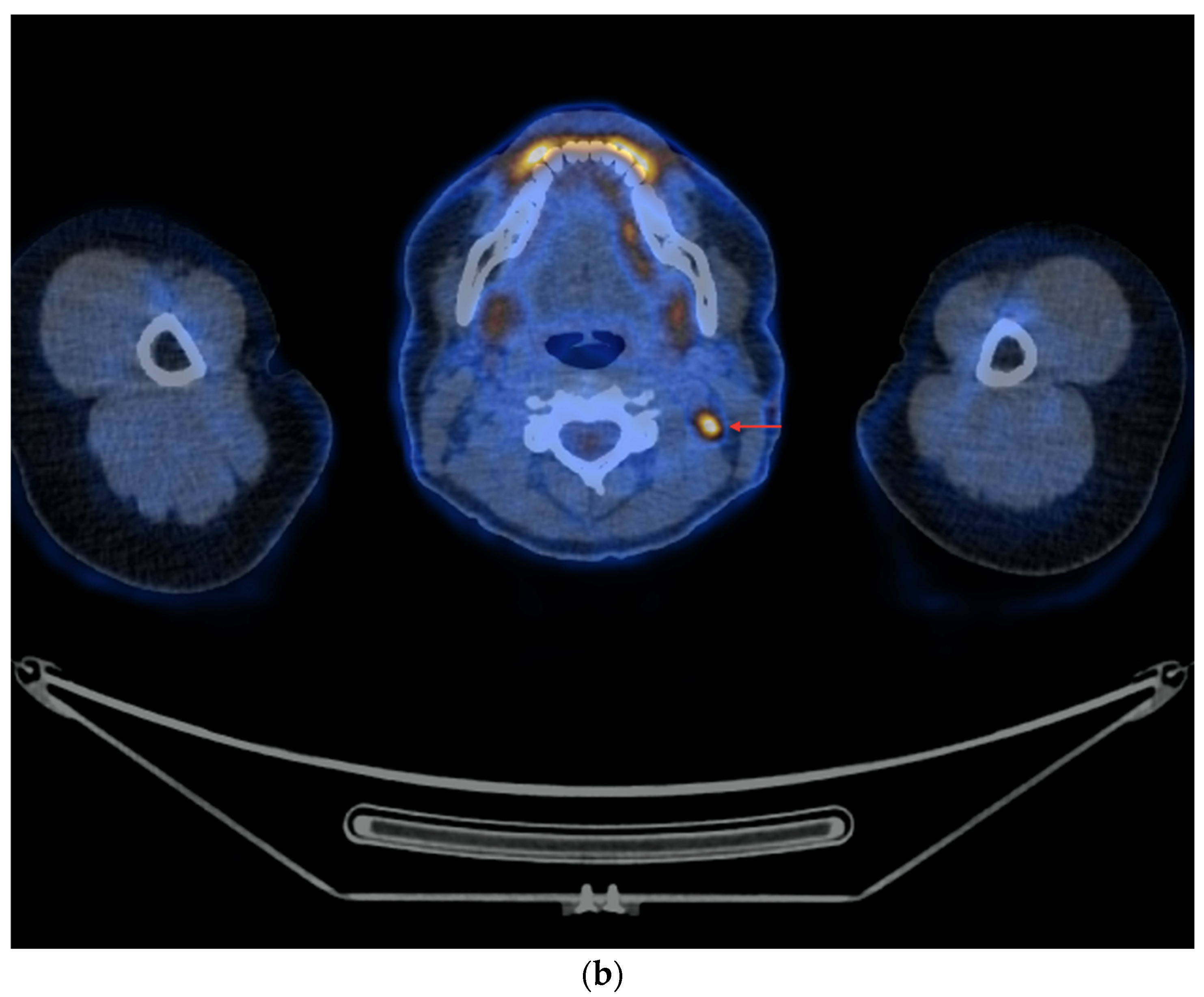 Cancers 16 03413 g003b