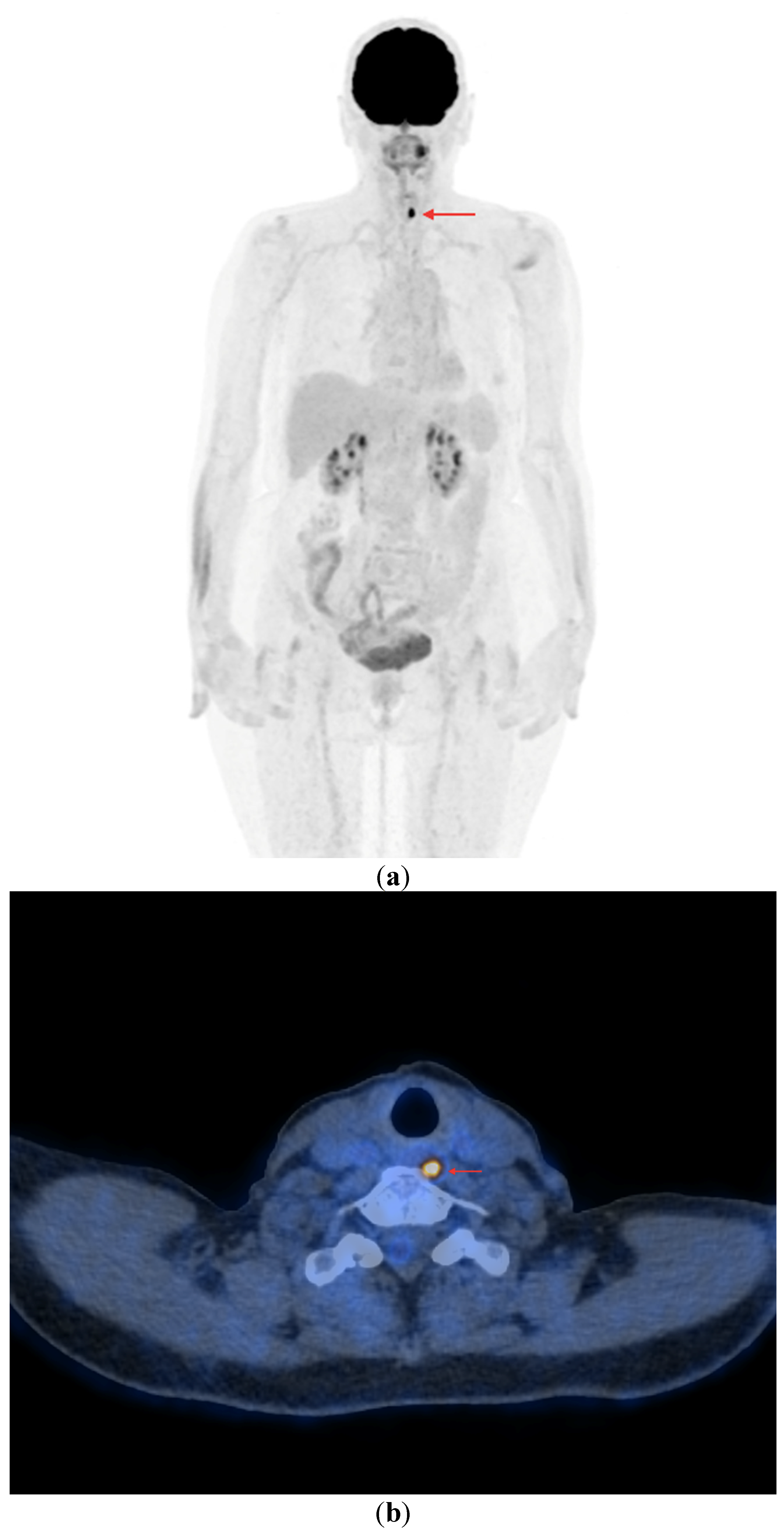 Cancers 16 03413 g004