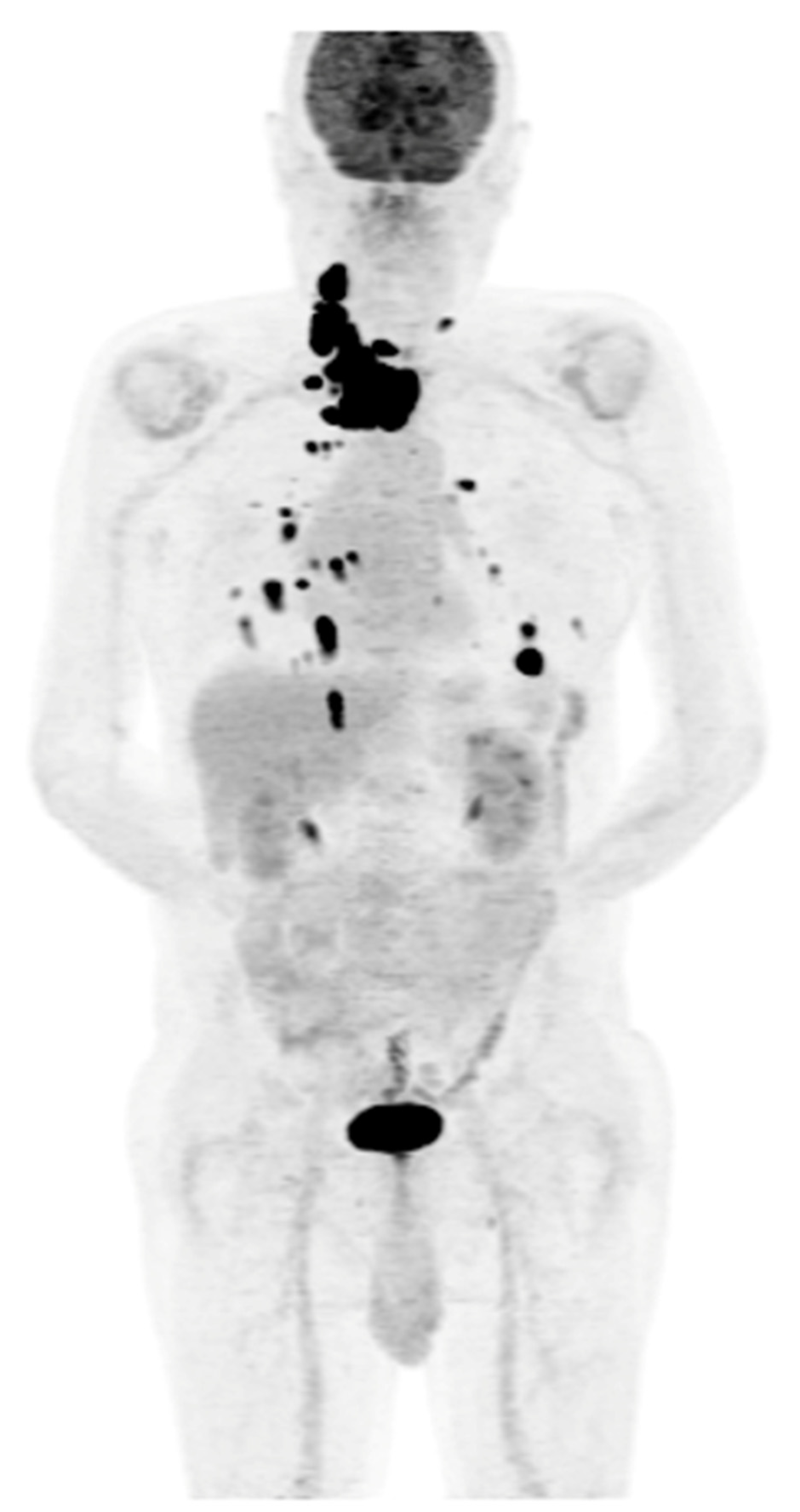 Cancers 16 03413 g005