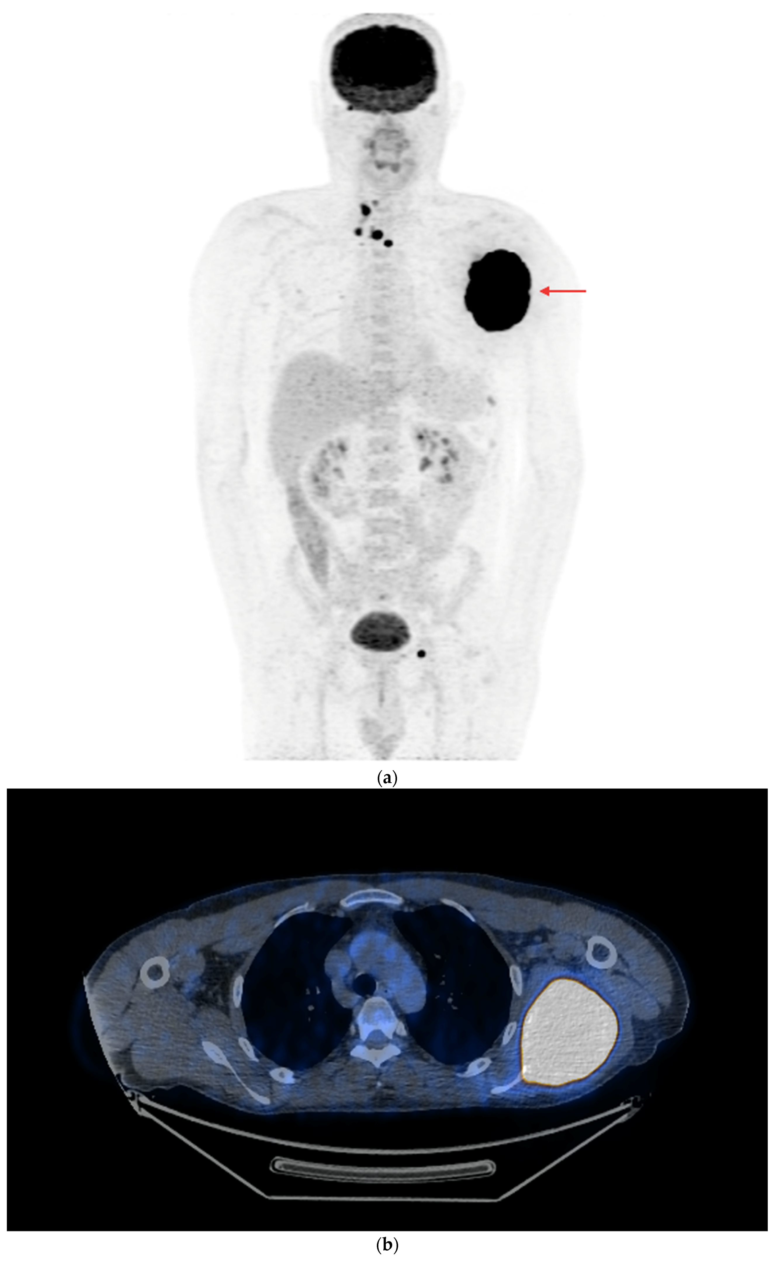 Cancers 16 03413 g006