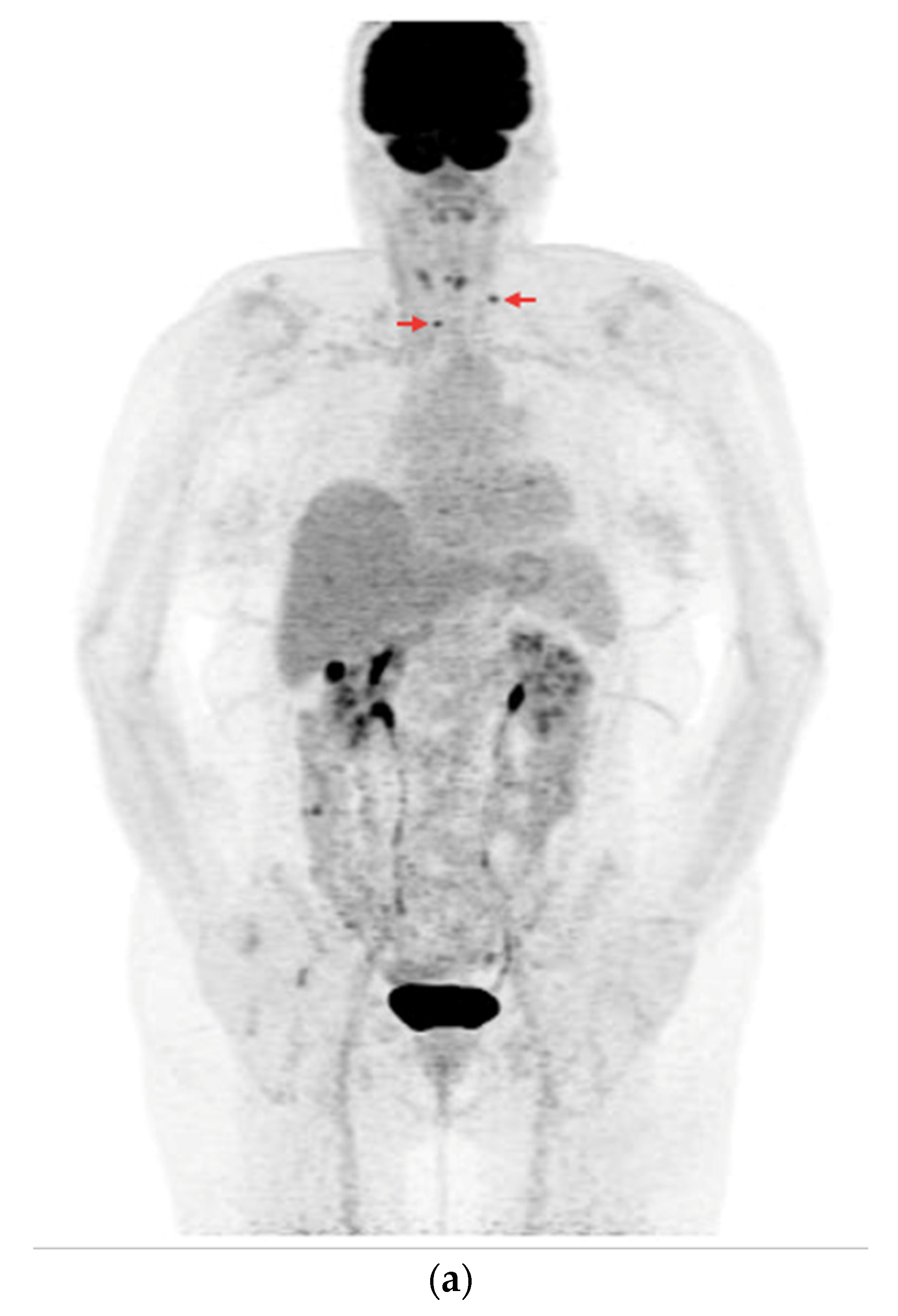 Cancers 16 03413 g007a