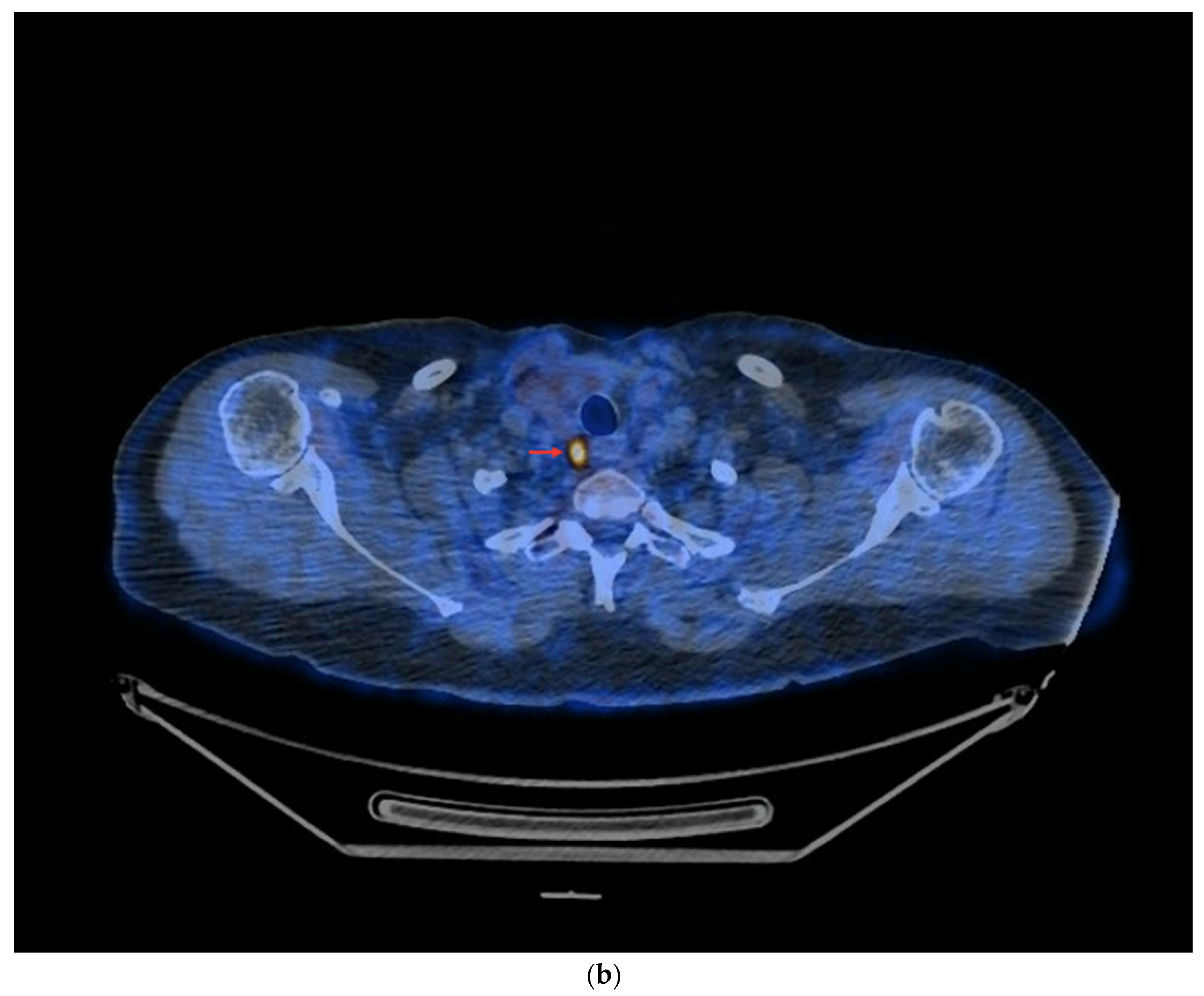 Cancers 16 03413 g007b