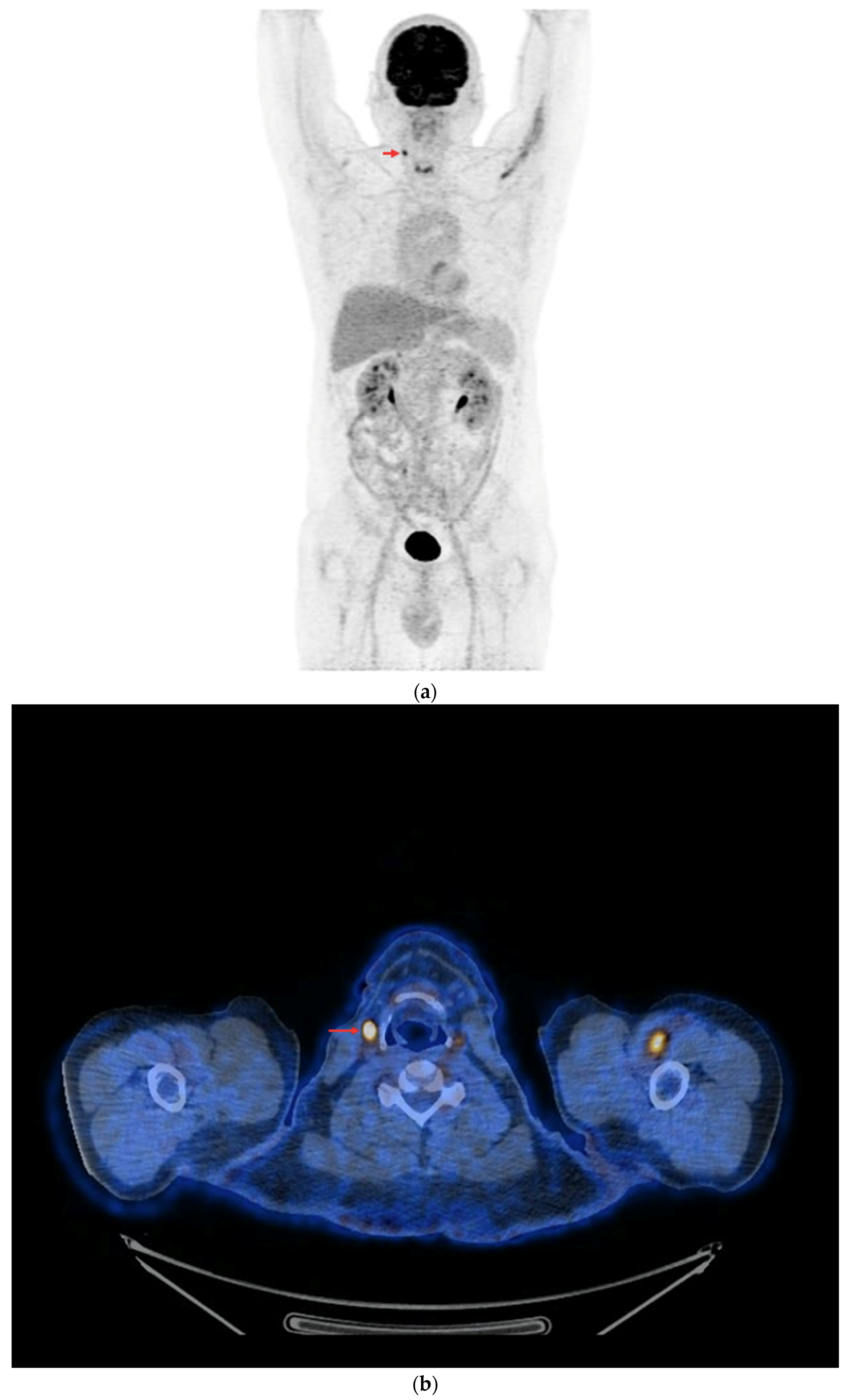 Cancers 16 03413 g008