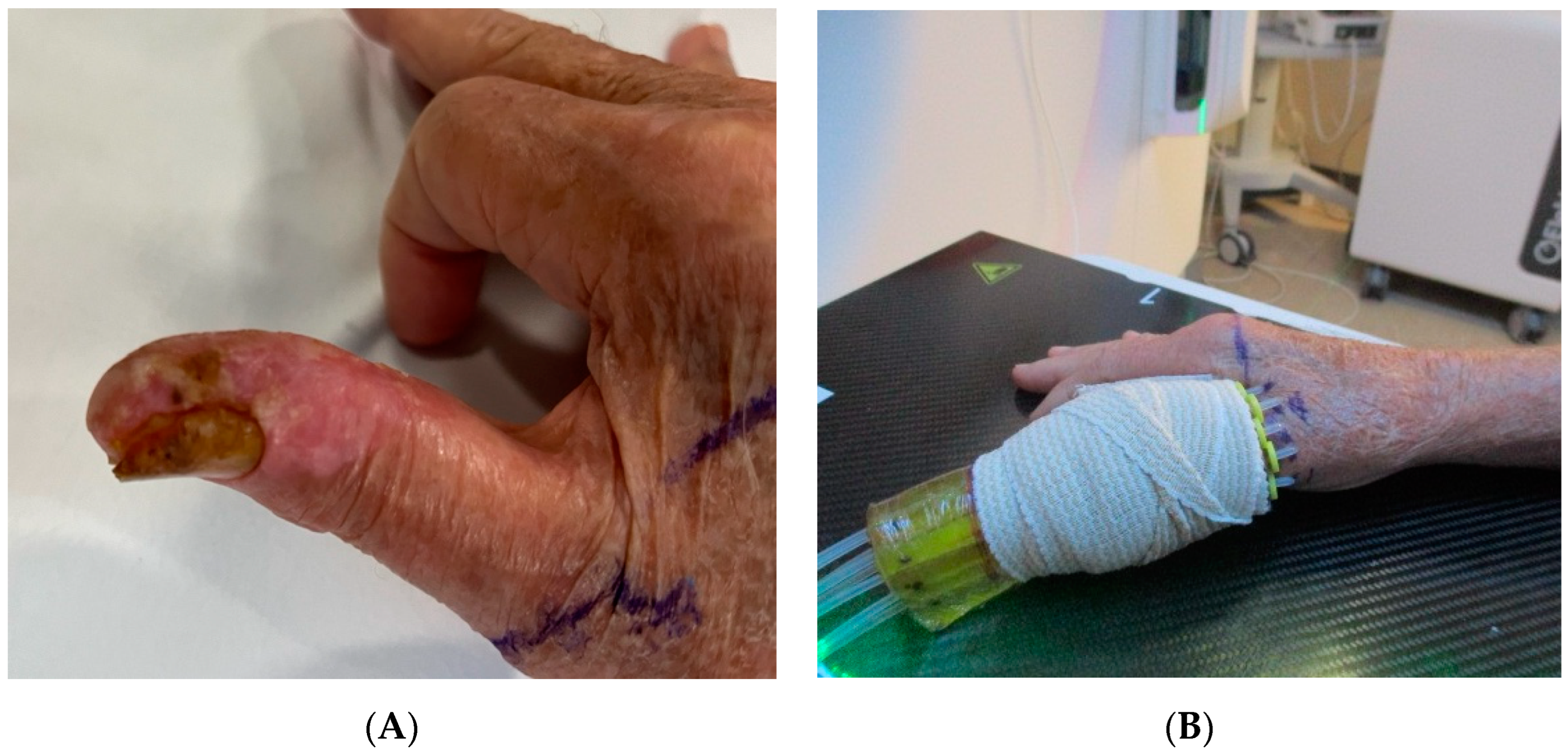 Cancers 16 03424 g001