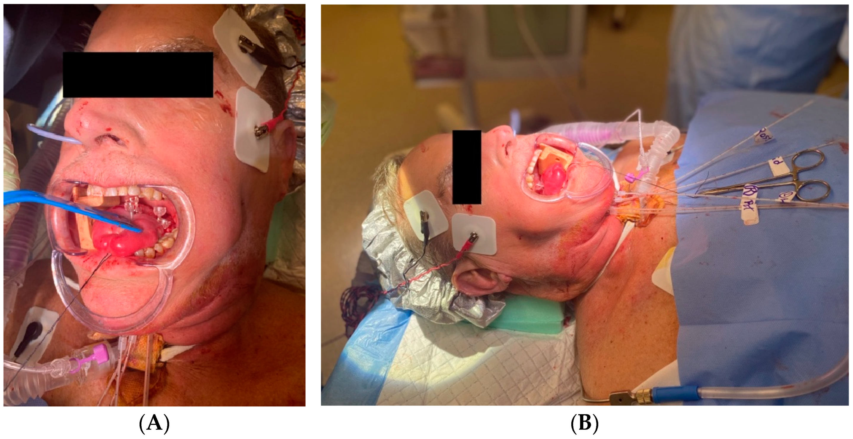 Cancers 16 03424 g004