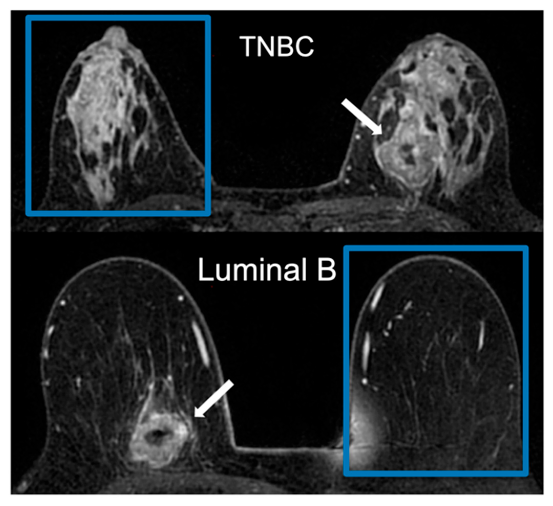 Cancers 16 03480 g002