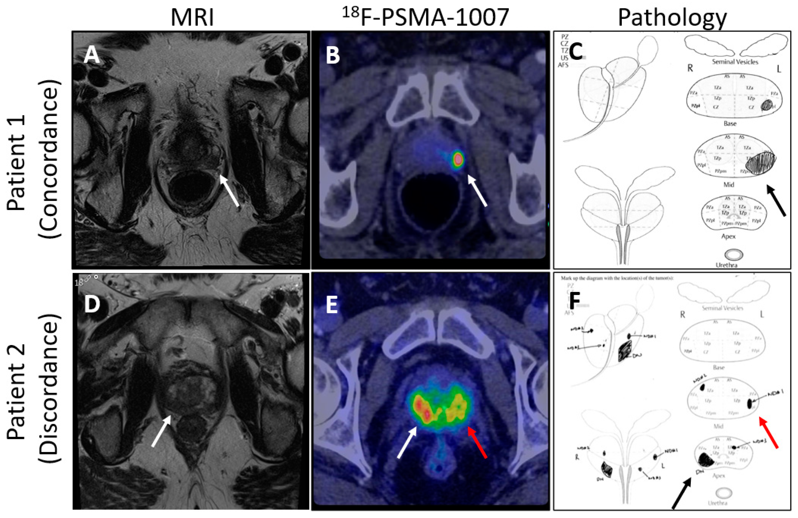 Cancers 16 03490 g002