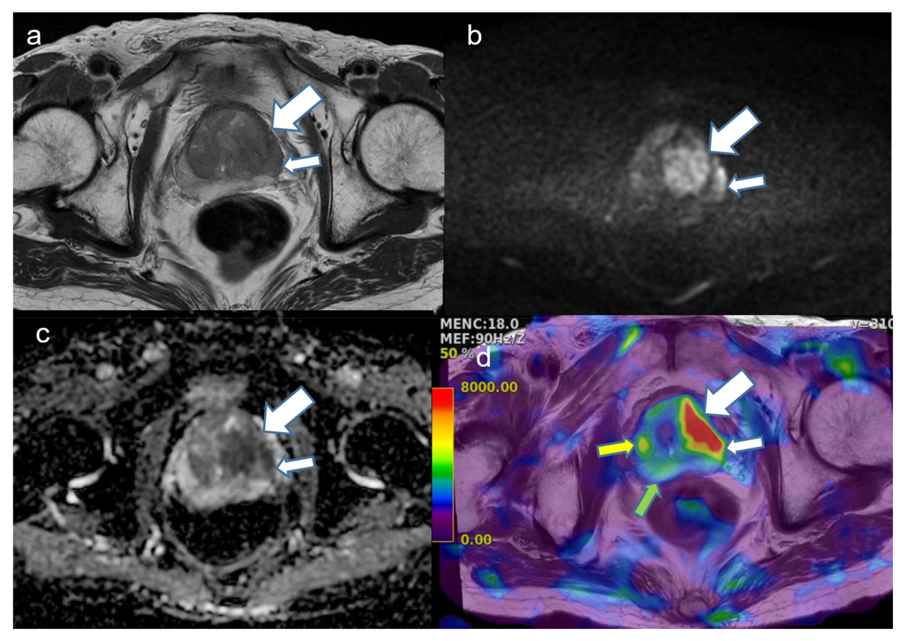 Cancers 16 03494 g002