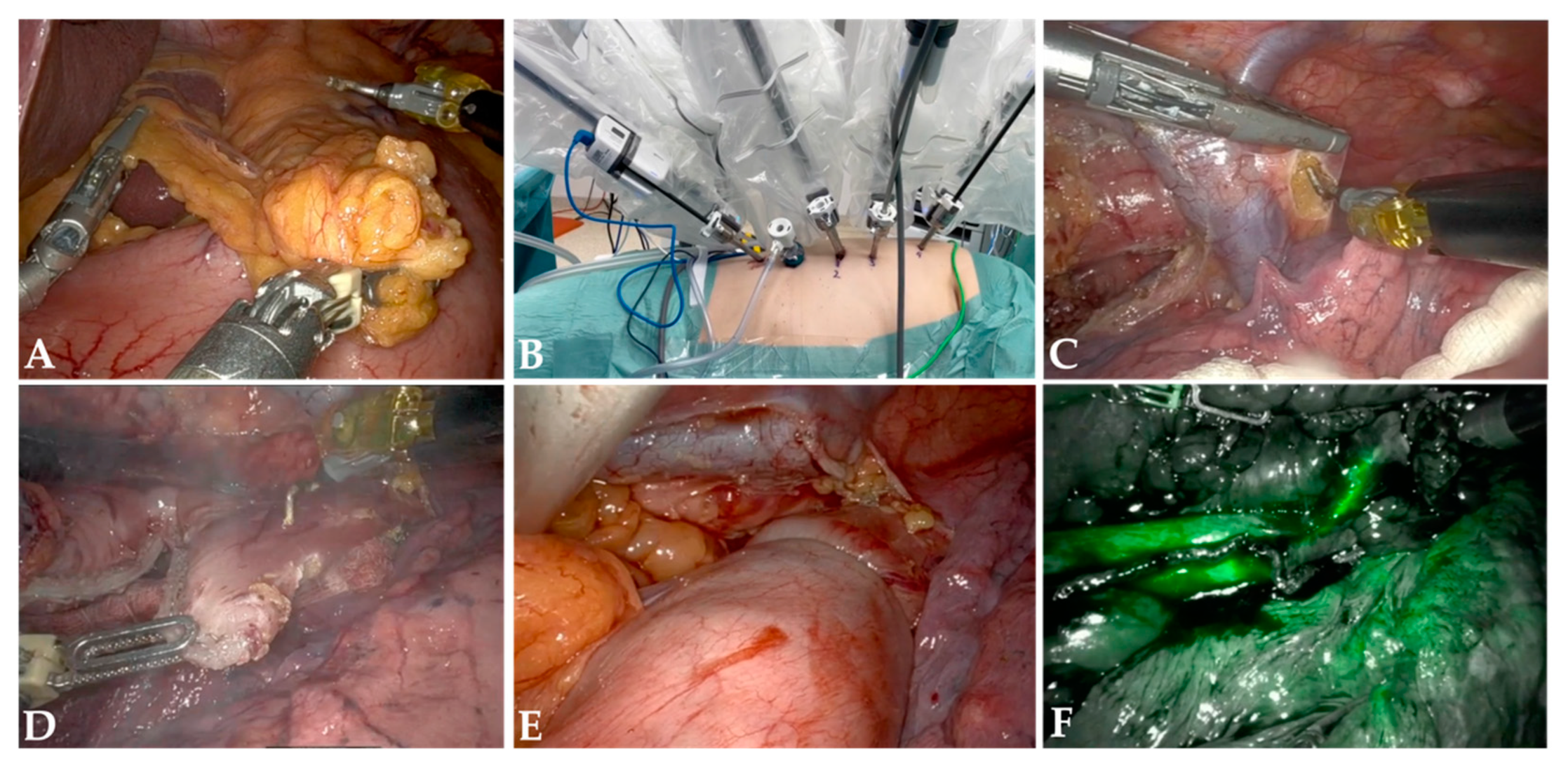 Cancers 16 03538 g001