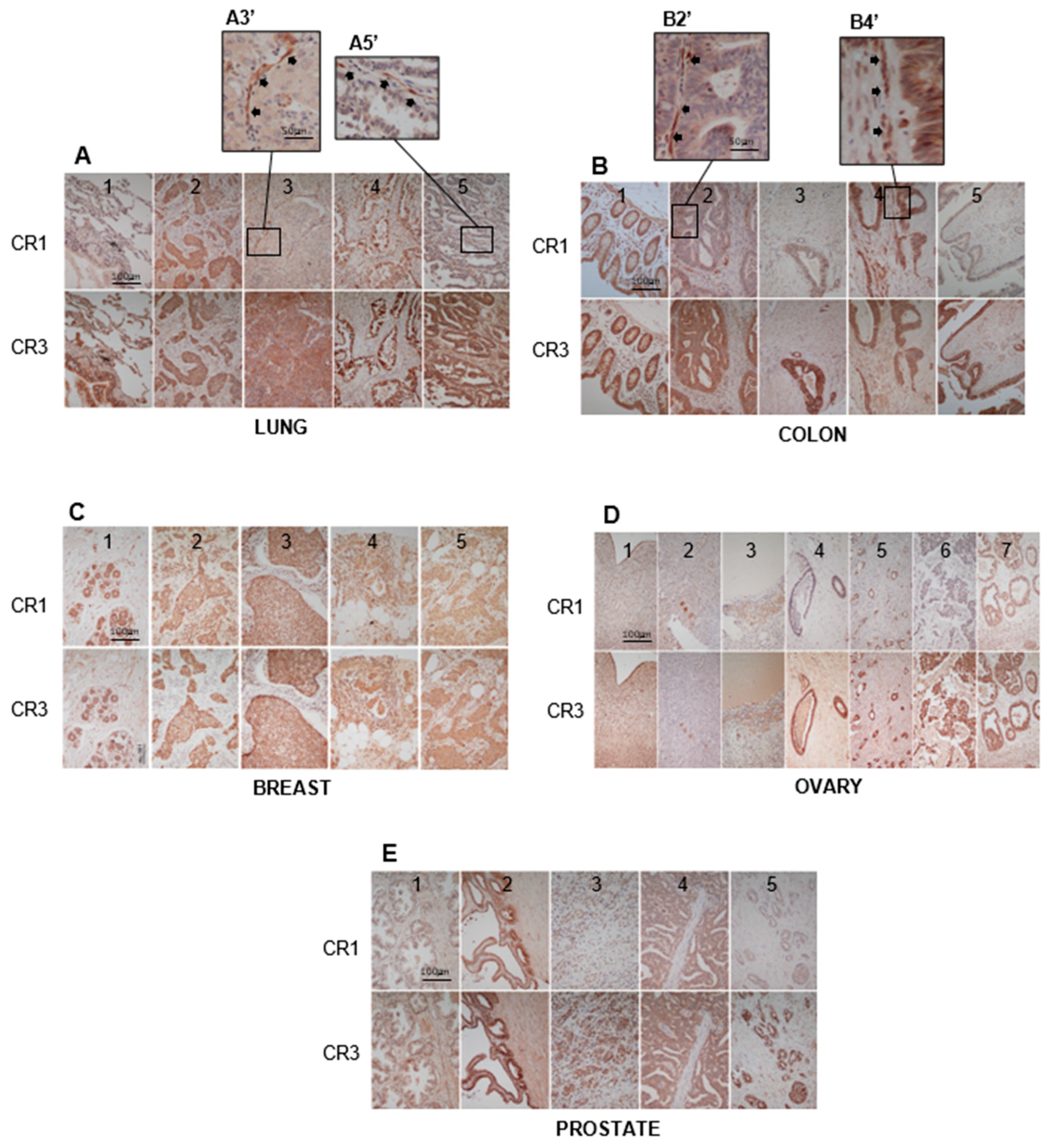 Cancers 16 03577 g004 Cancers 16 03577 g004