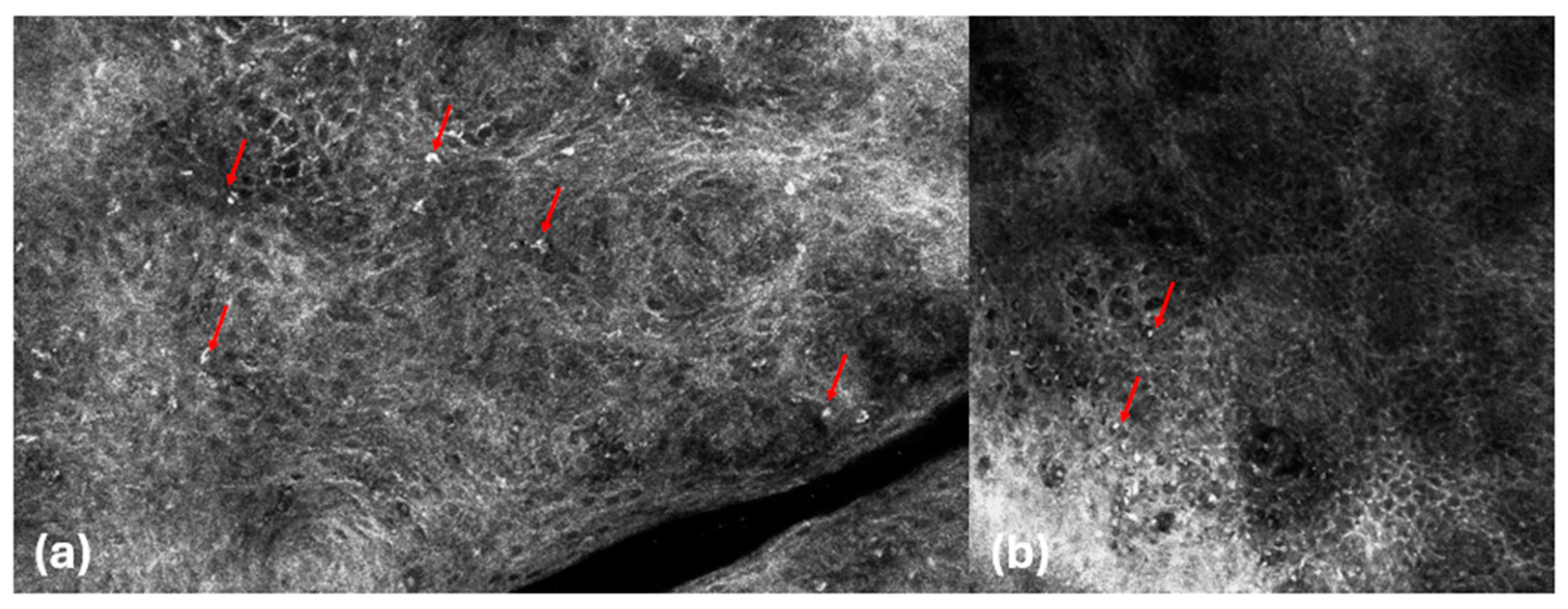 Cancers 16 03608 g002