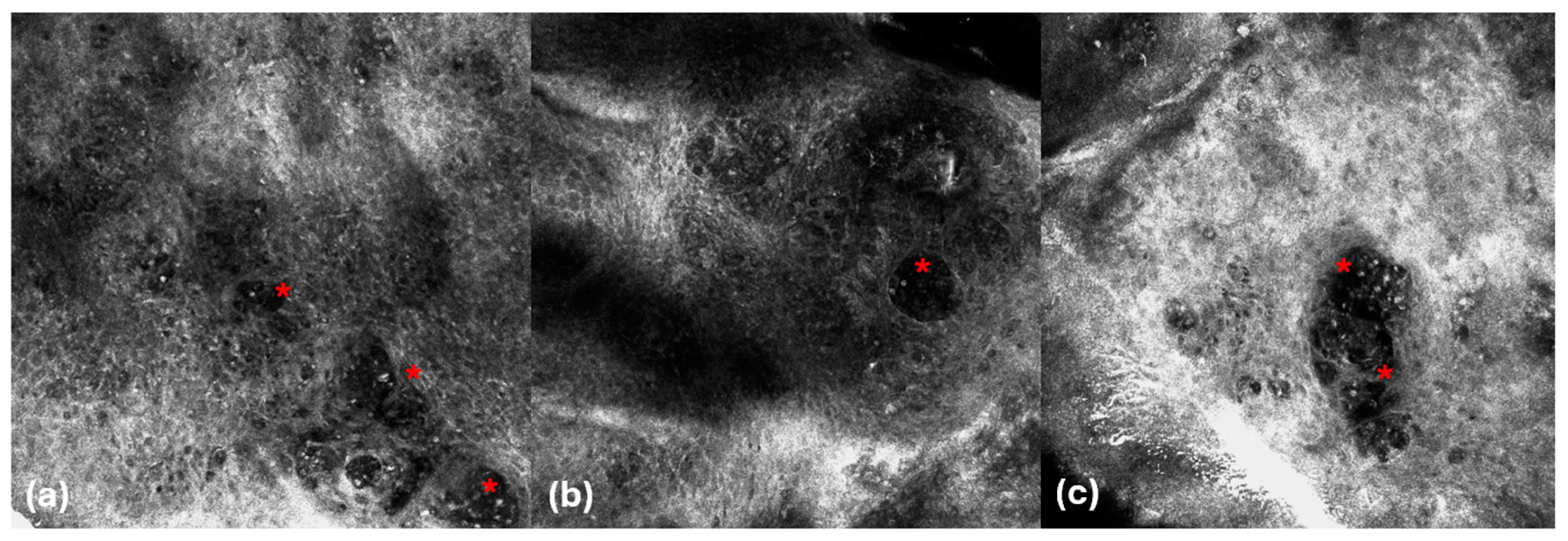 Cancers 16 03608 g004