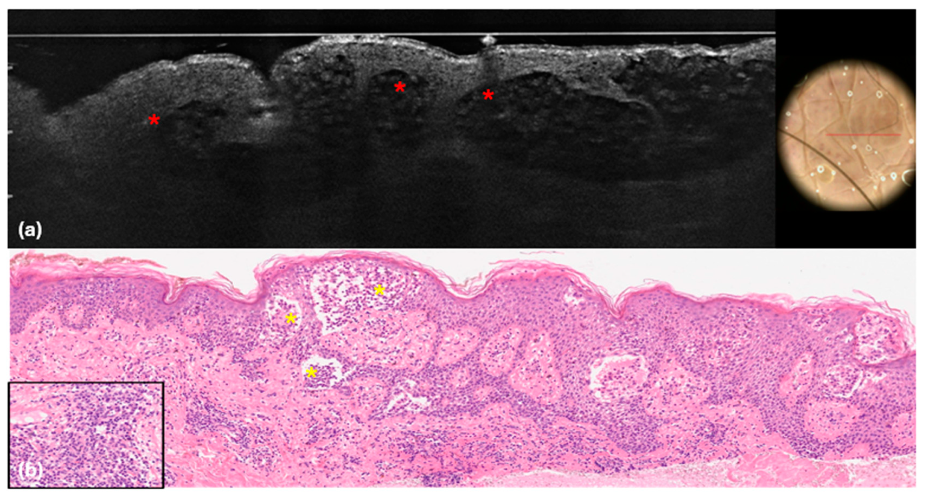 Cancers 16 03608 g005