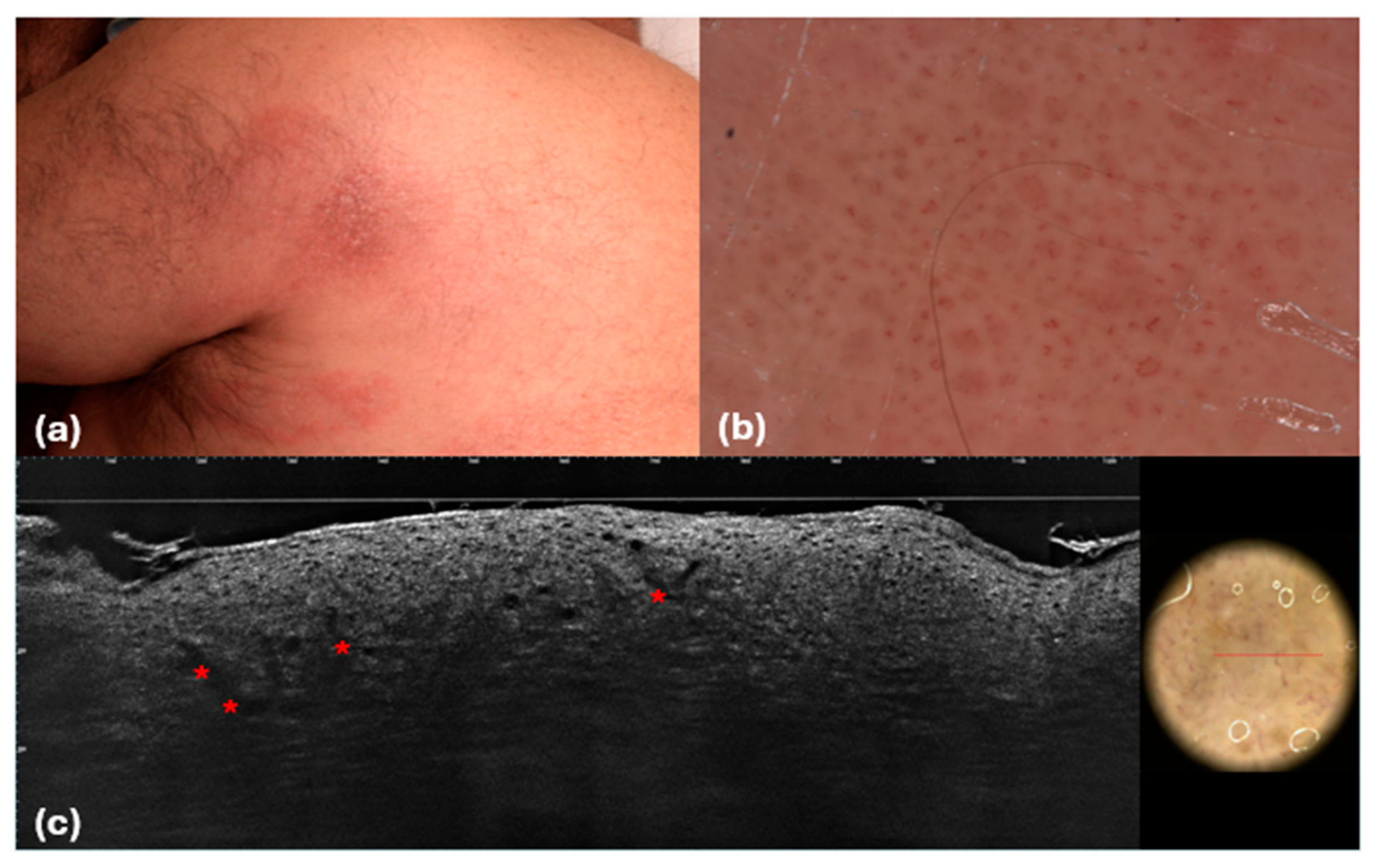 Cancers 16 03608 g006