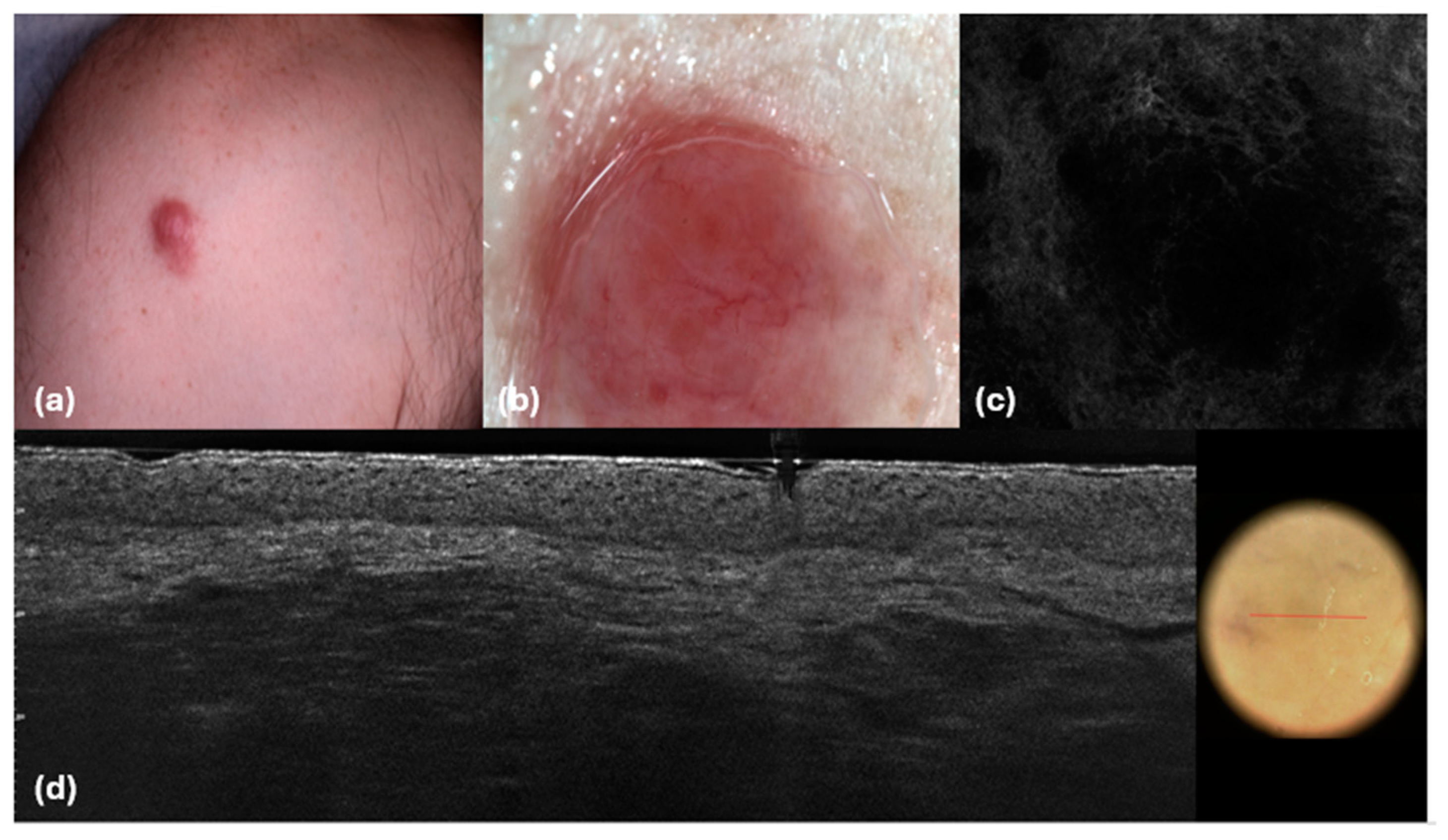 Cancers 16 03608 g007