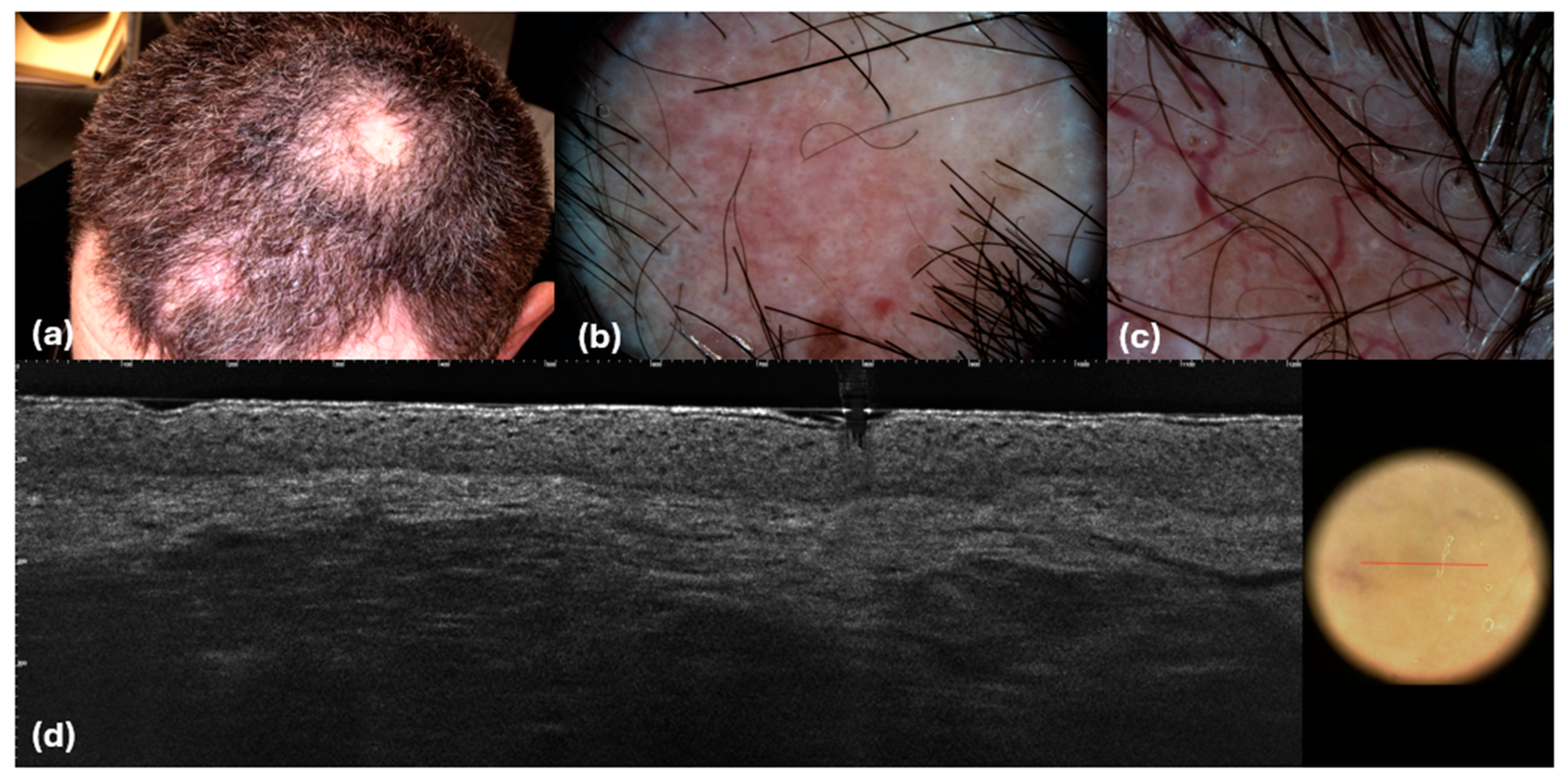 Cancers 16 03608 g008