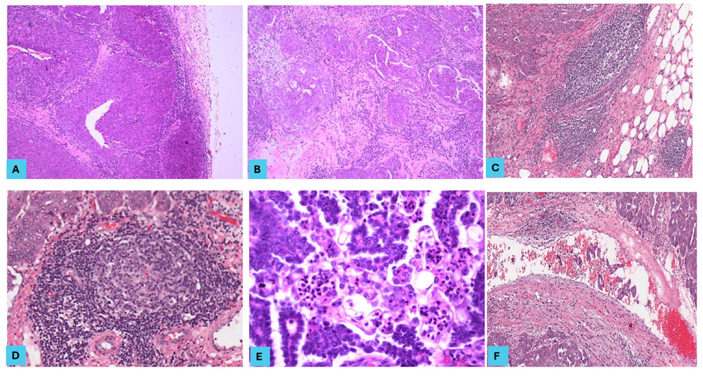 Cancers 16 03611 g001