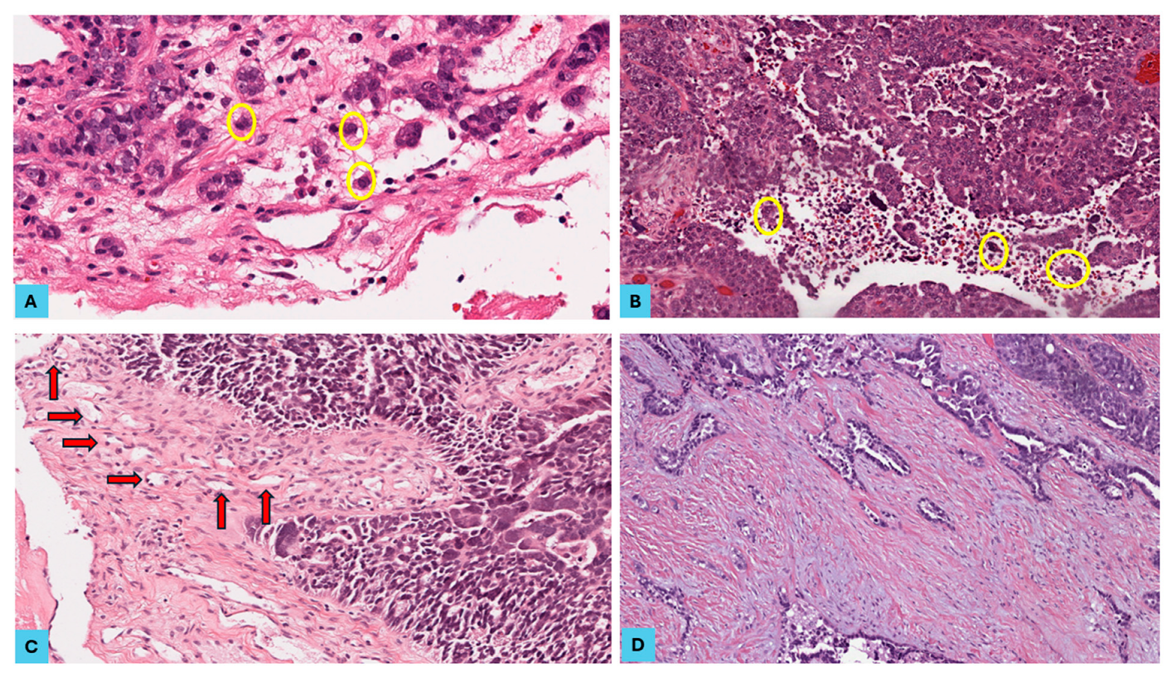 Cancers 16 03611 g002