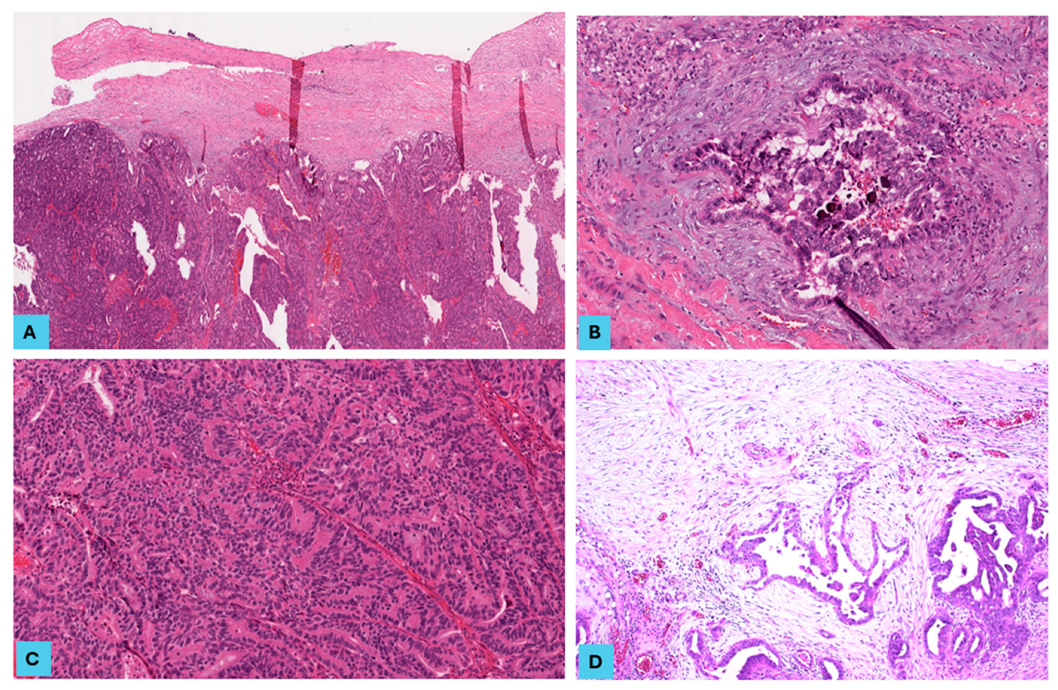 Cancers 16 03611 g003