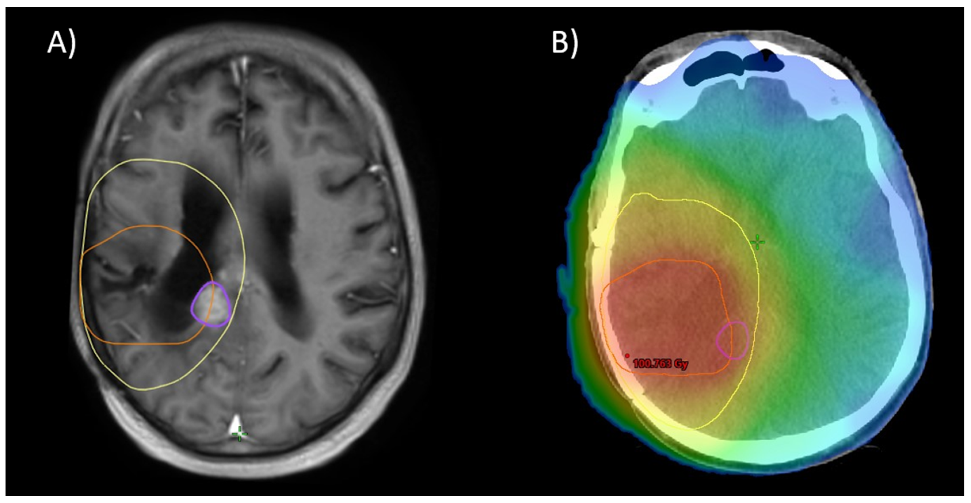 Cancers 16 03652 g006