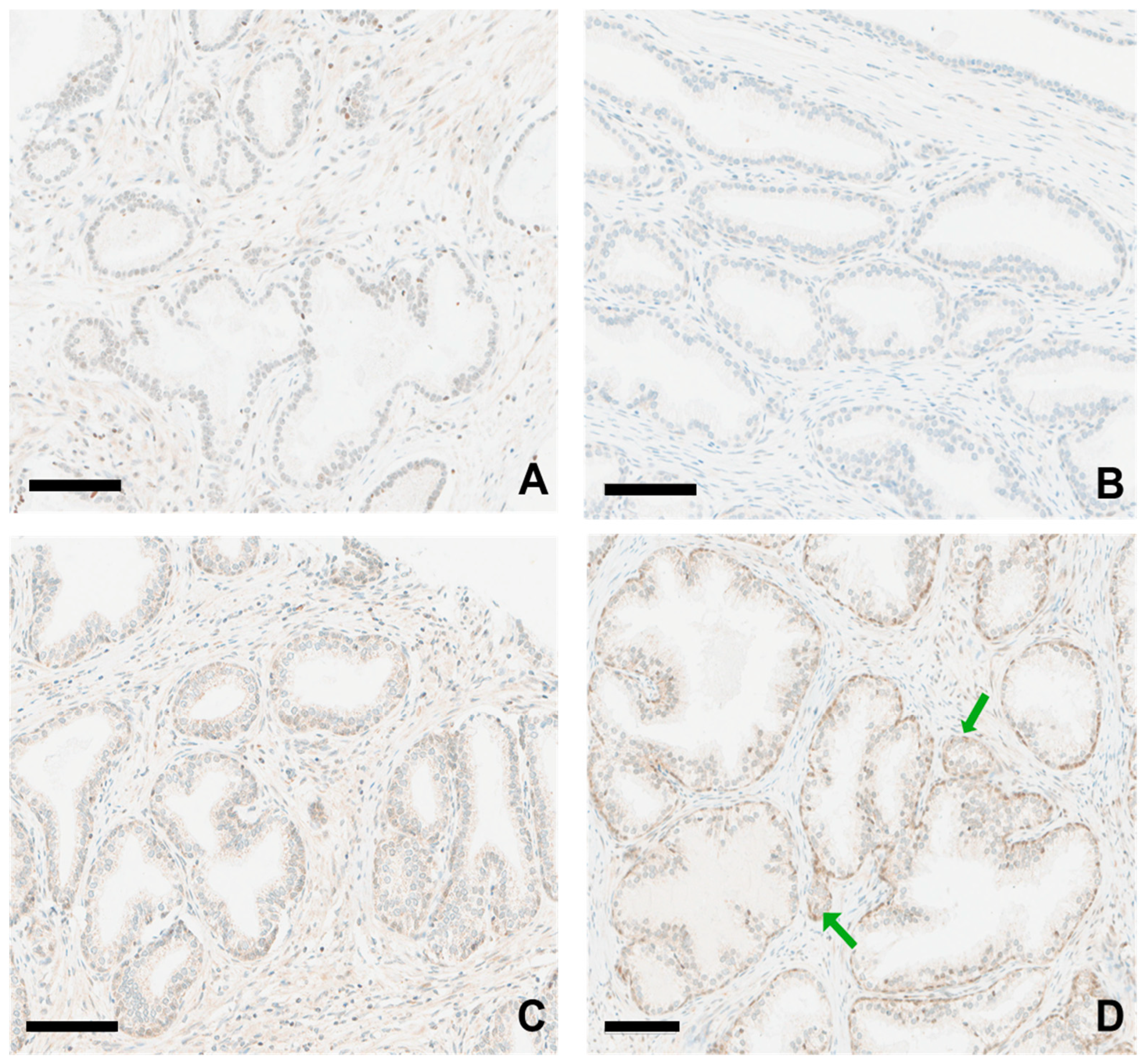 Cancers 16 03659 g003