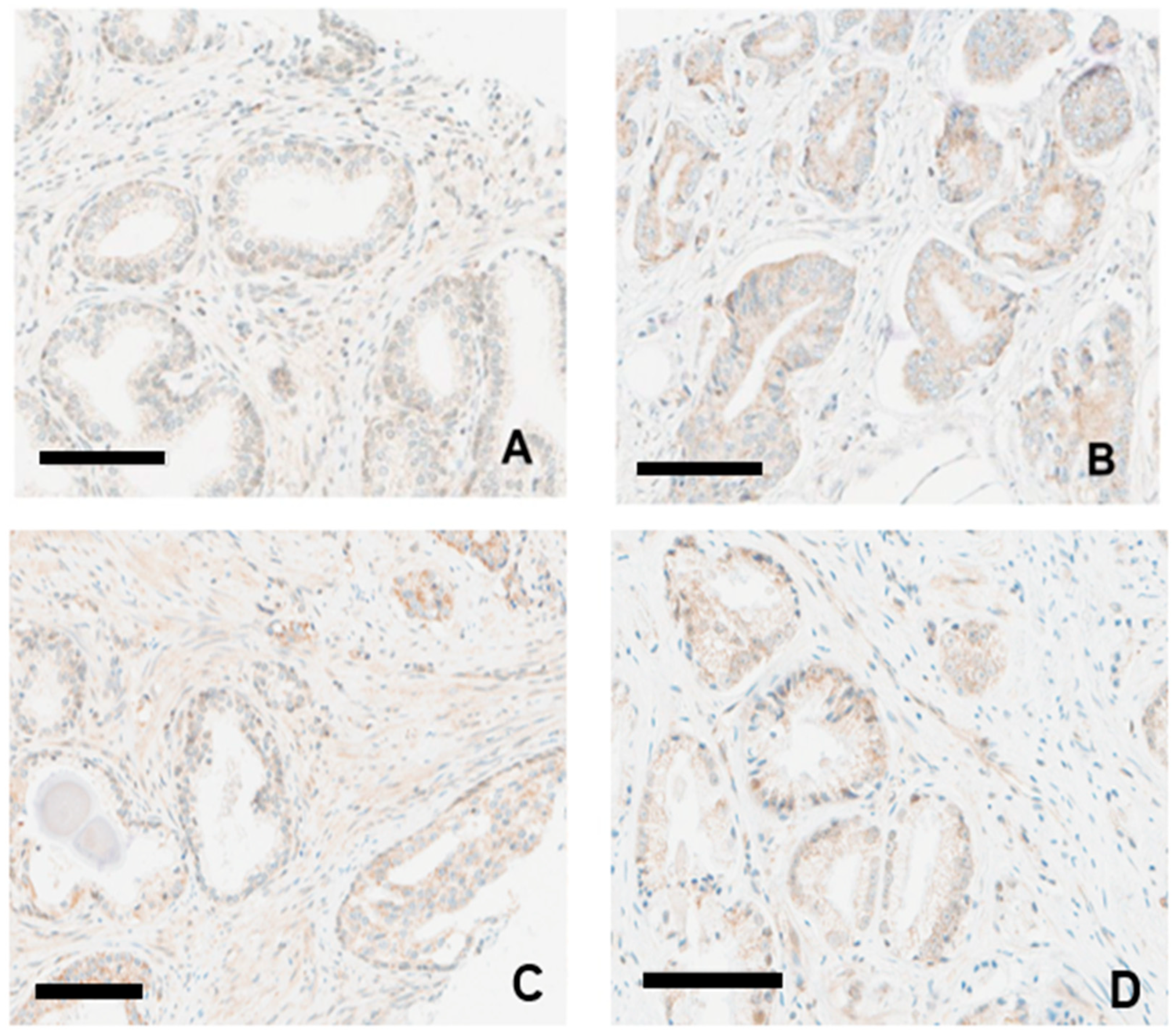 Cancers 16 03659 g004