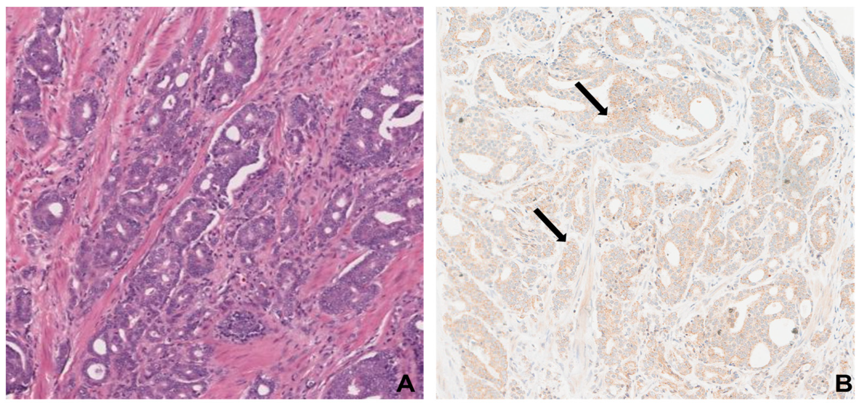 Cancers 16 03659 g005