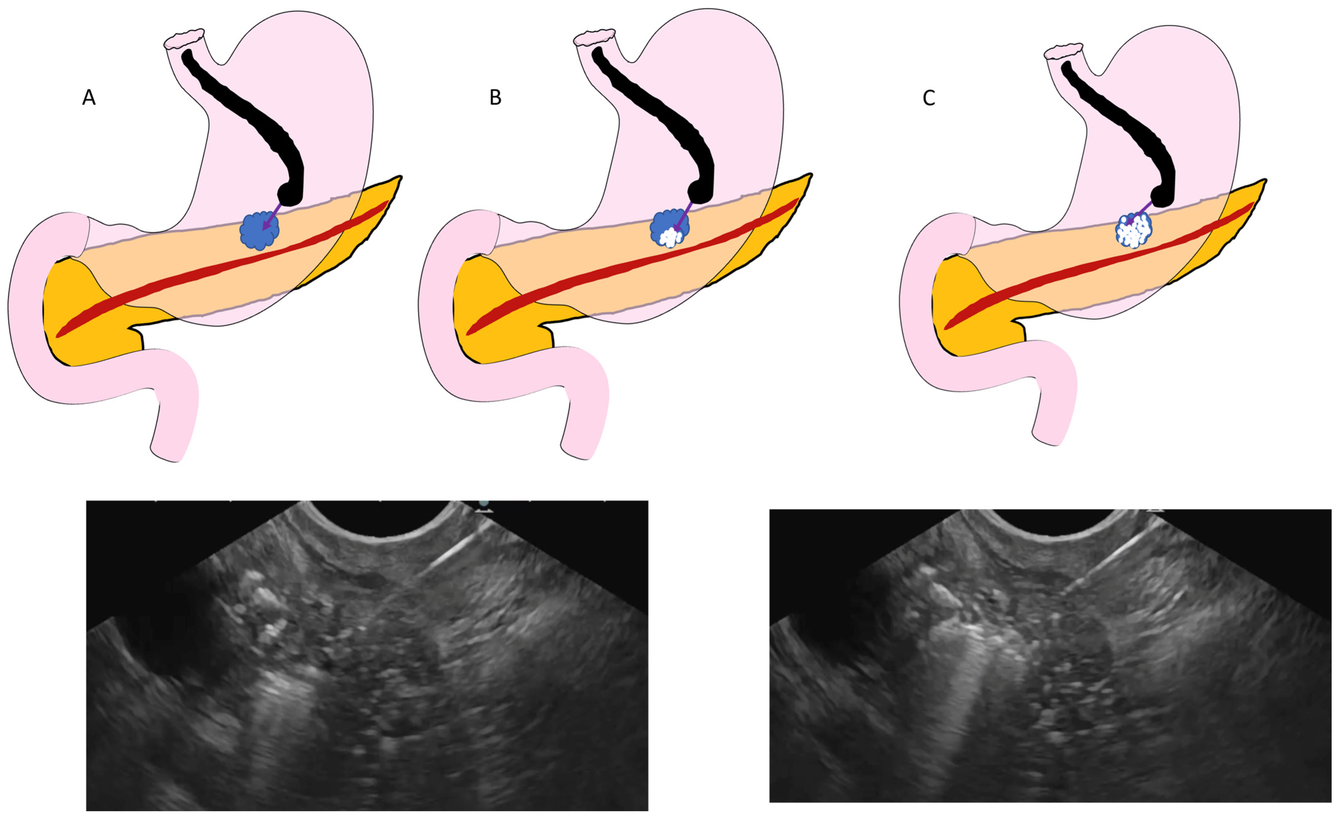 Cancers 16 03662 g001