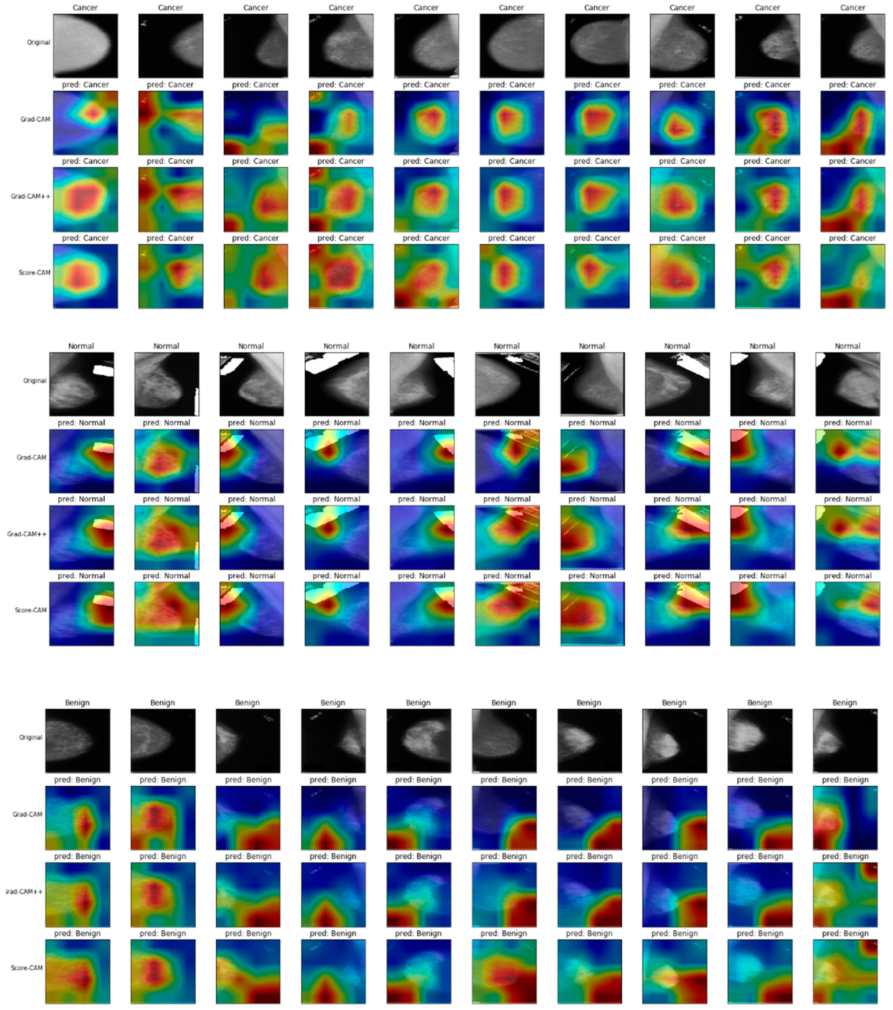 Cancers 16 03668 g005