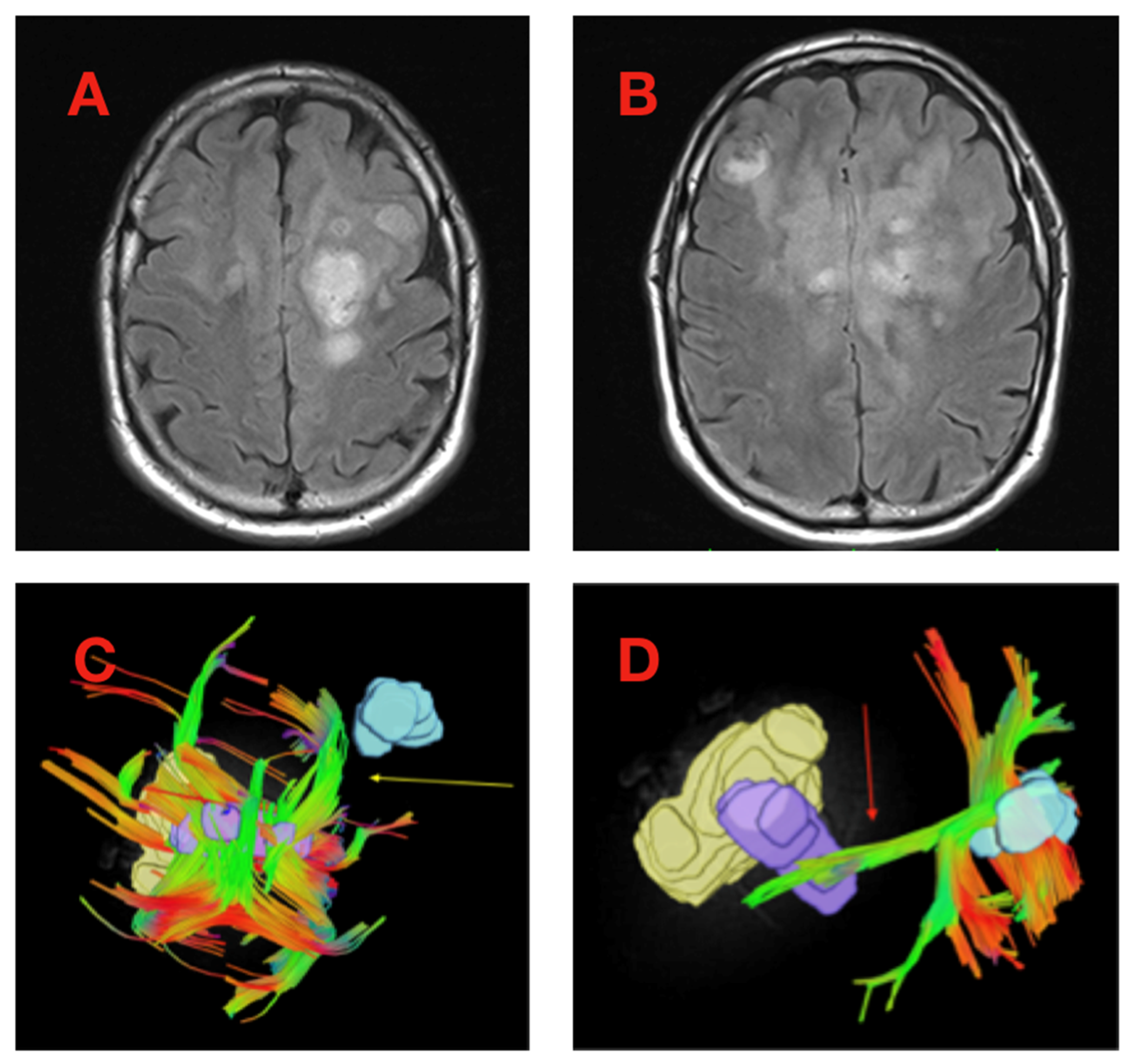 Cancers 16 03669 g002