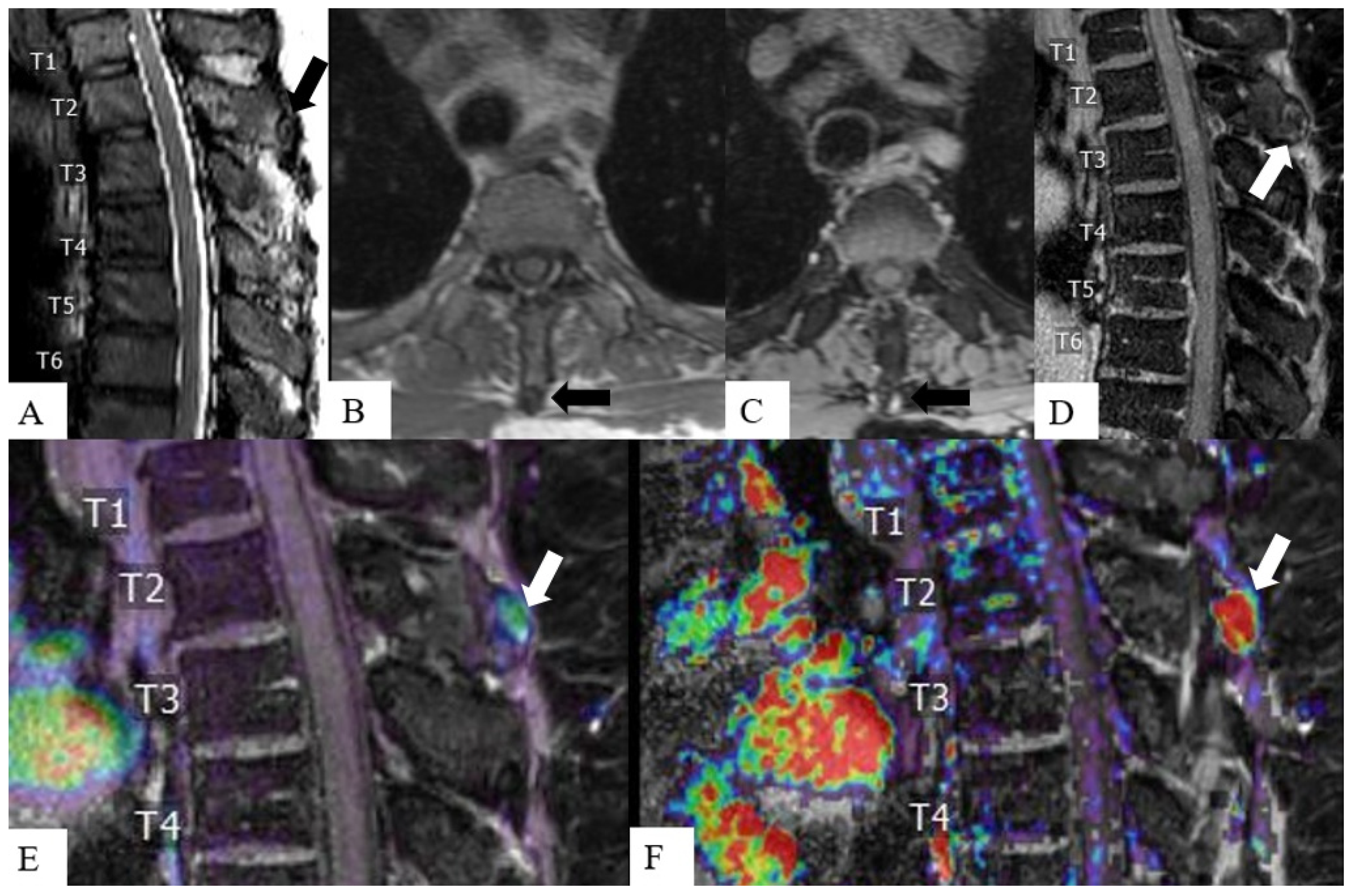 Cancers 16 03692 g004