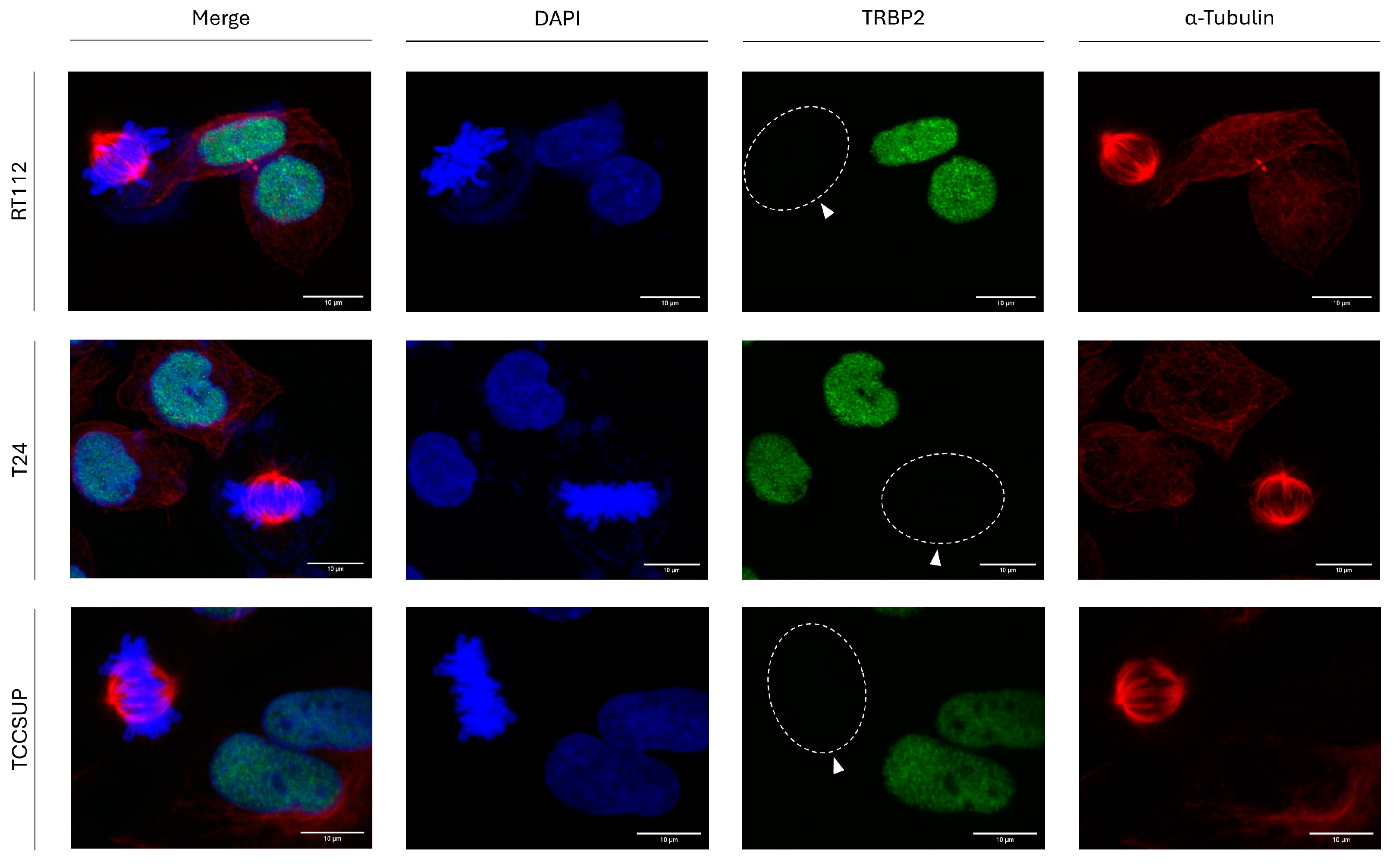 Cancers 16 03701 g003