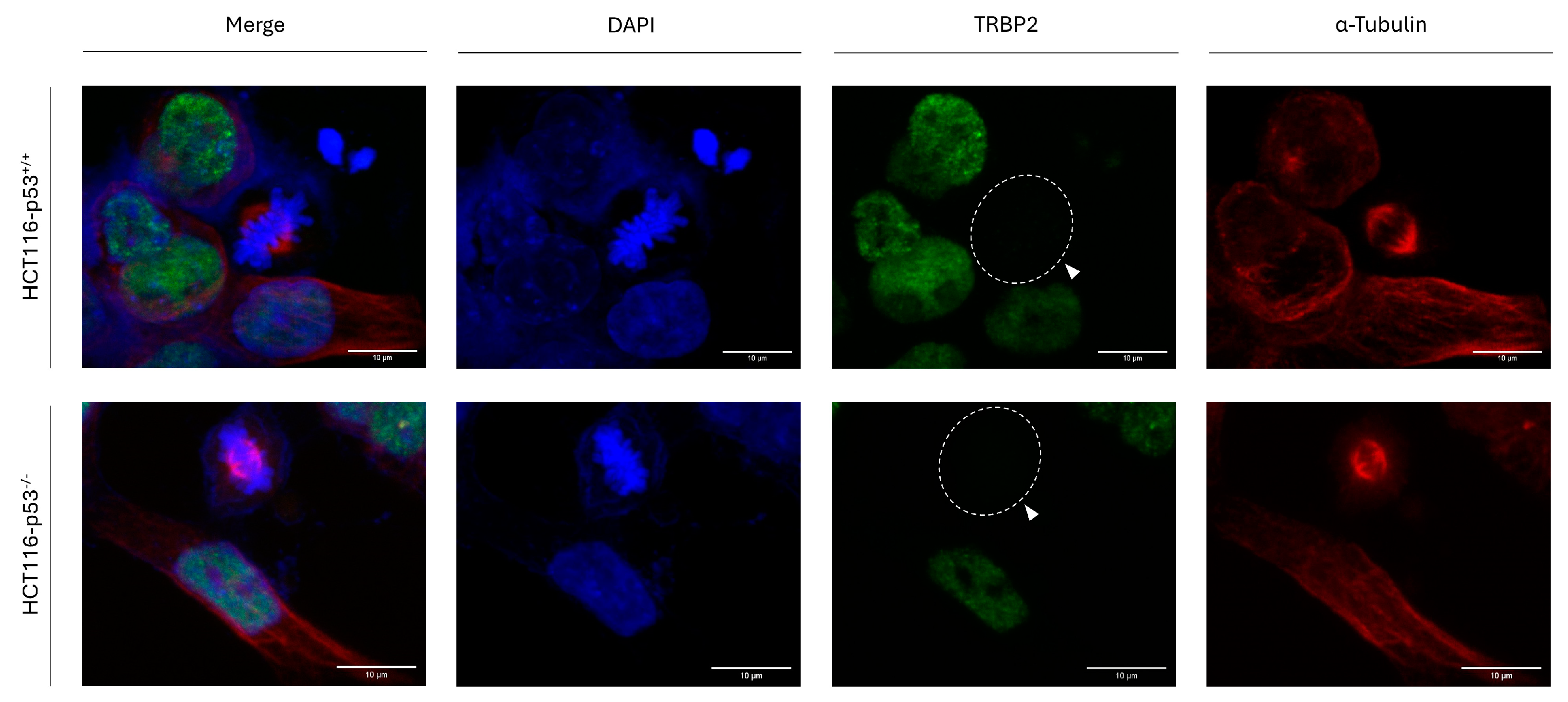 Cancers 16 03701 g004