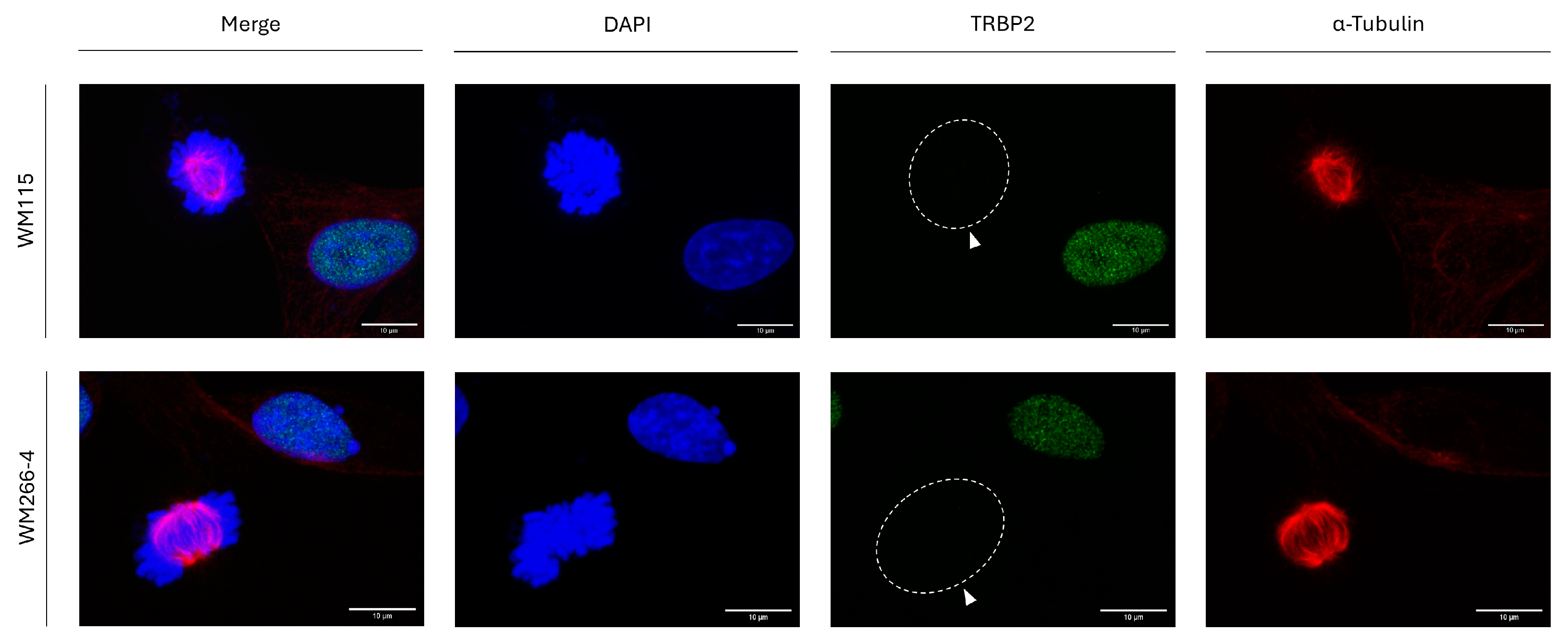 Cancers 16 03701 g005