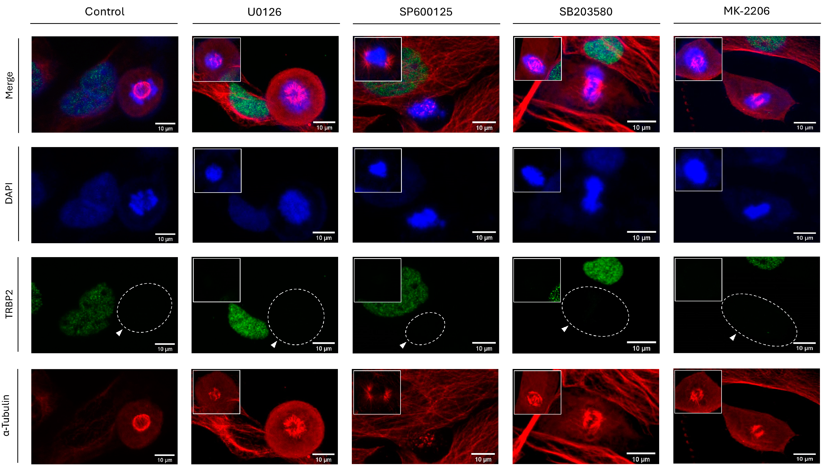 Cancers 16 03701 g011