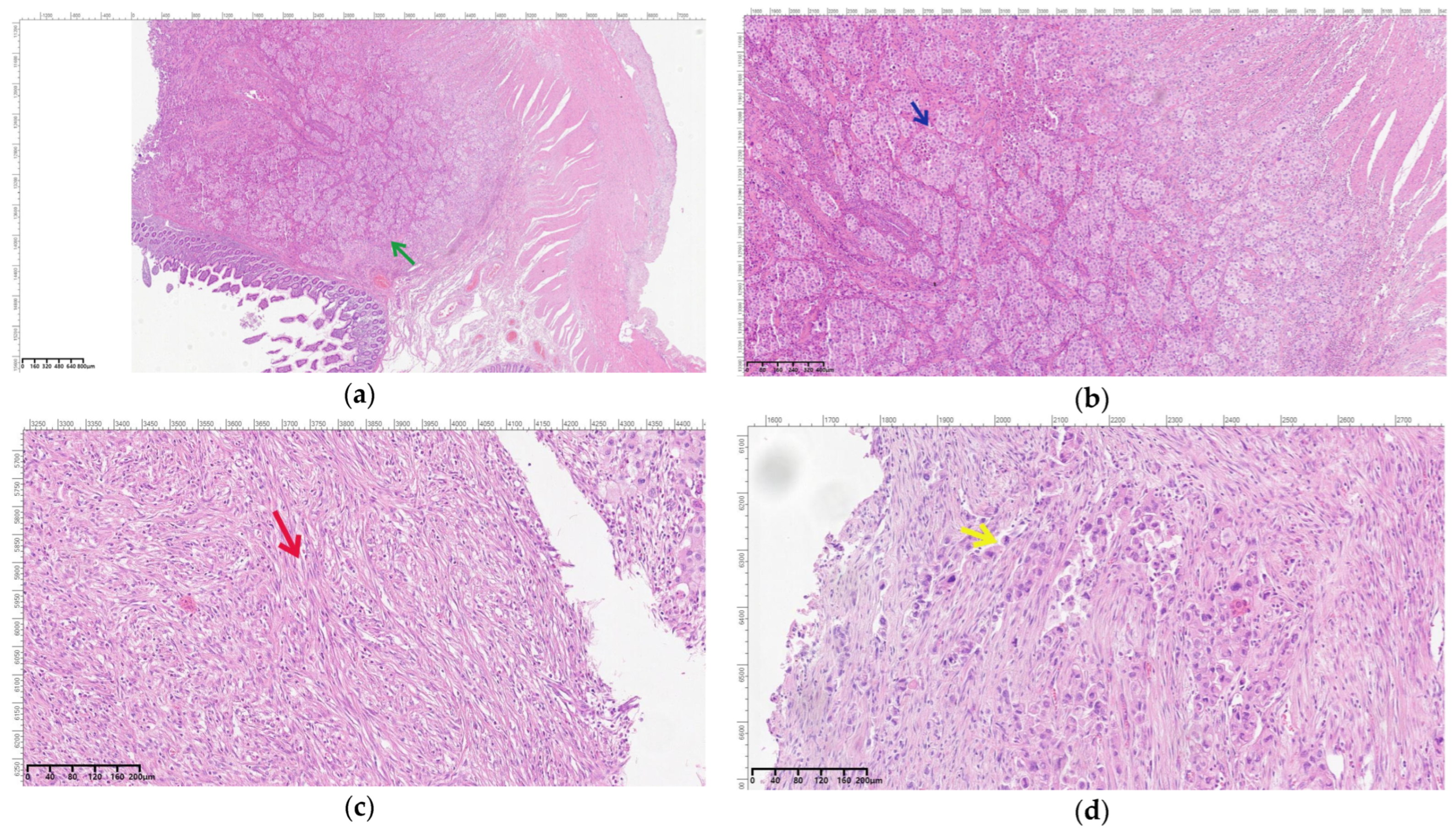 Cancers 16 03713 g009