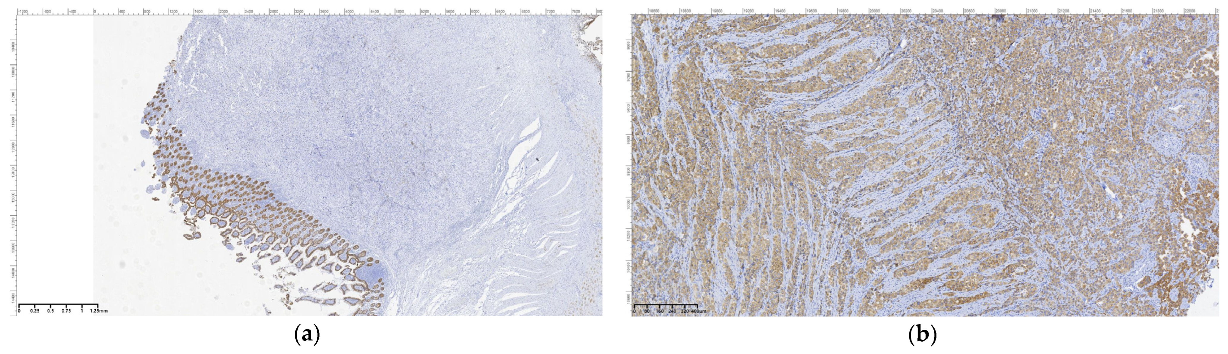 Cancers 16 03713 g010a