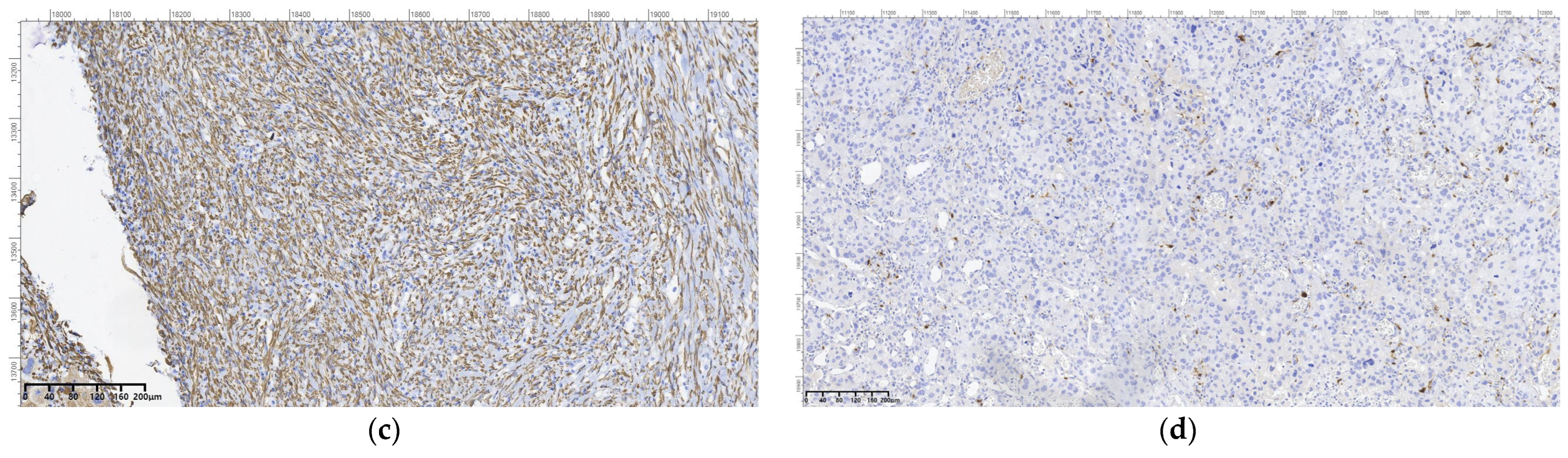 Cancers 16 03713 g010b