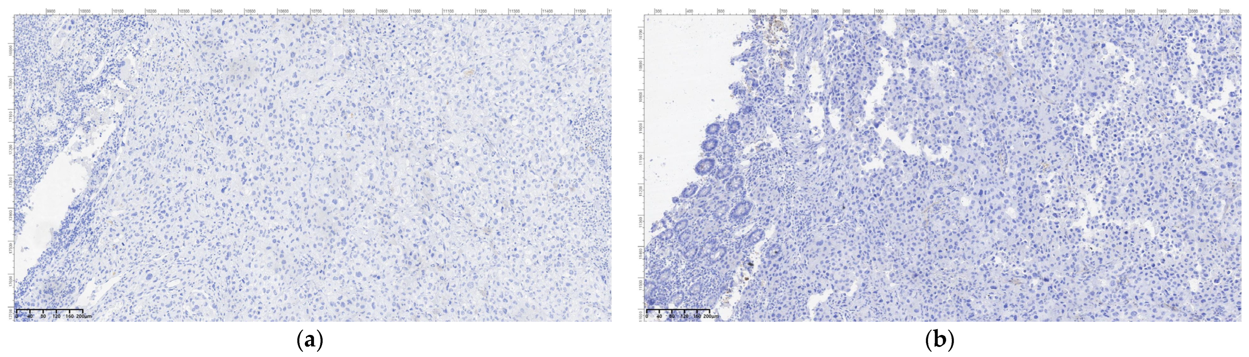 Cancers 16 03713 g012a