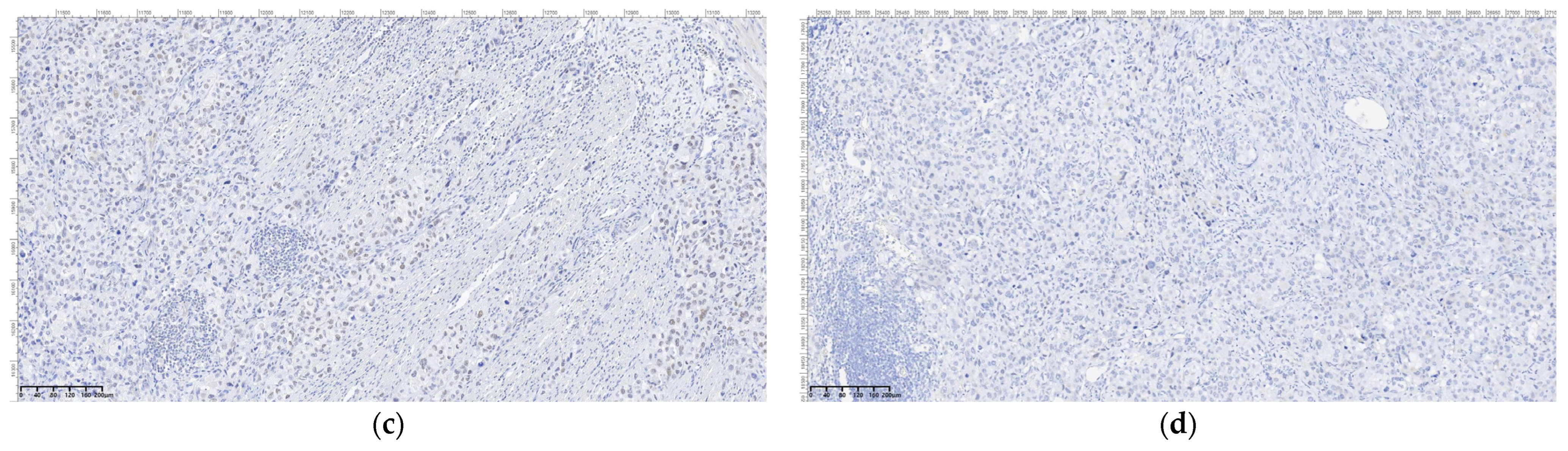 Cancers 16 03713 g012b