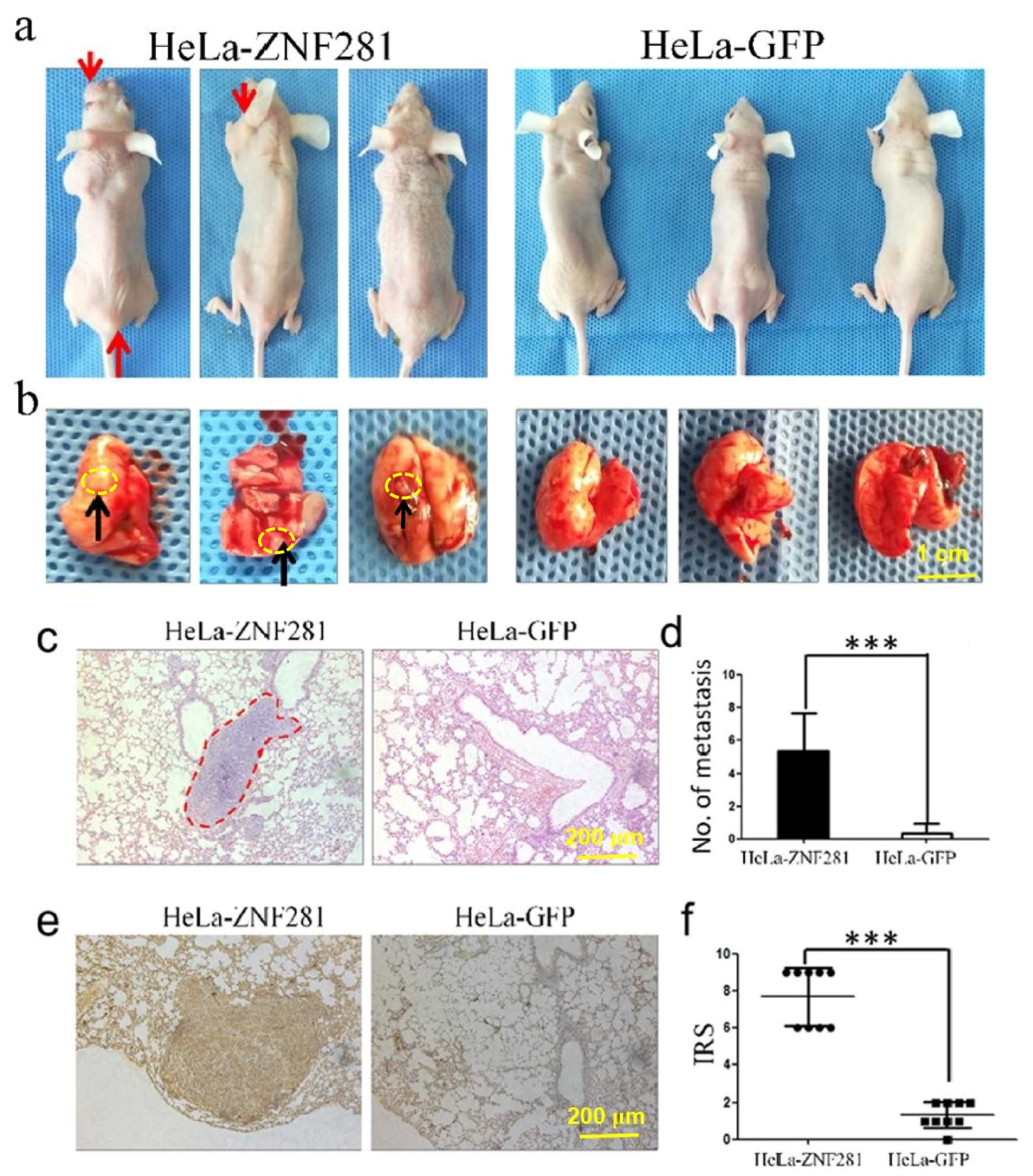 Cancers 16 03717 g005