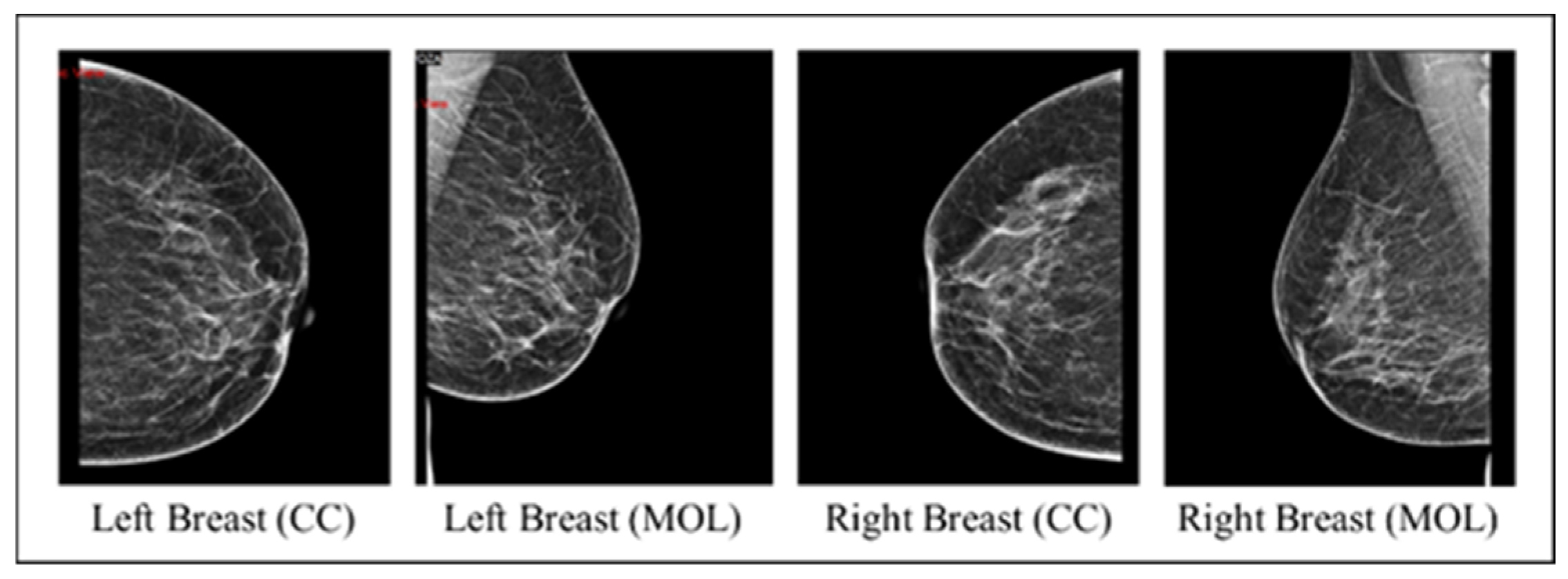 Cancers 16 03740 g002