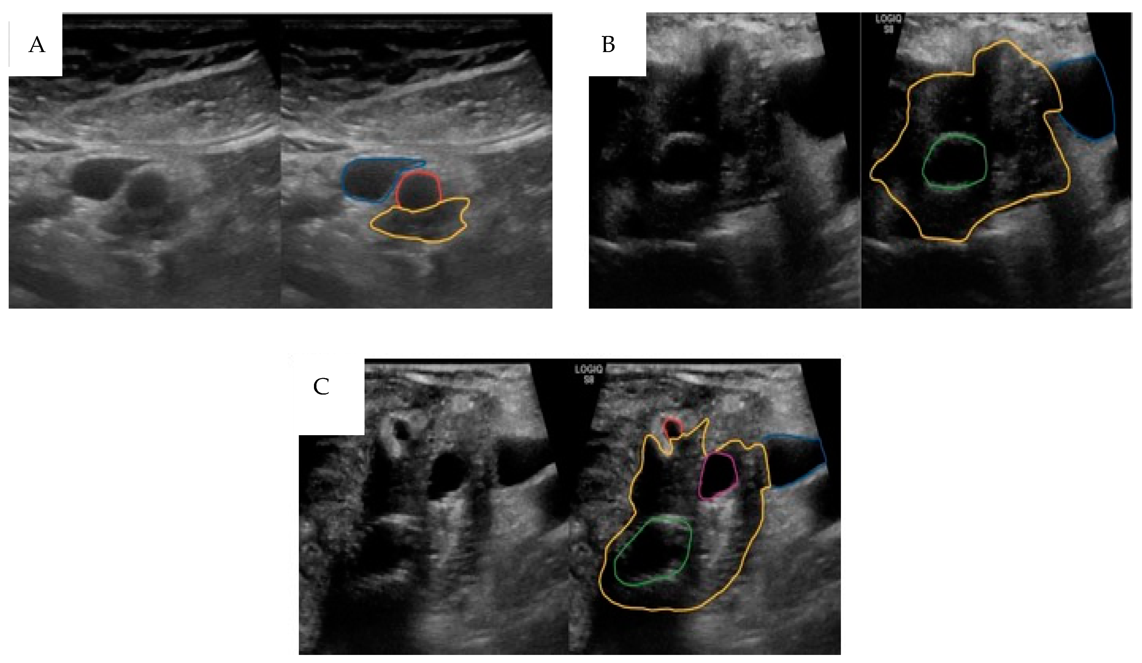 Cancers 16 03803 g001