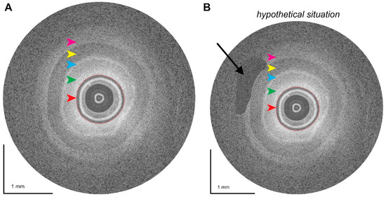 Cancers 16 03803 g003
