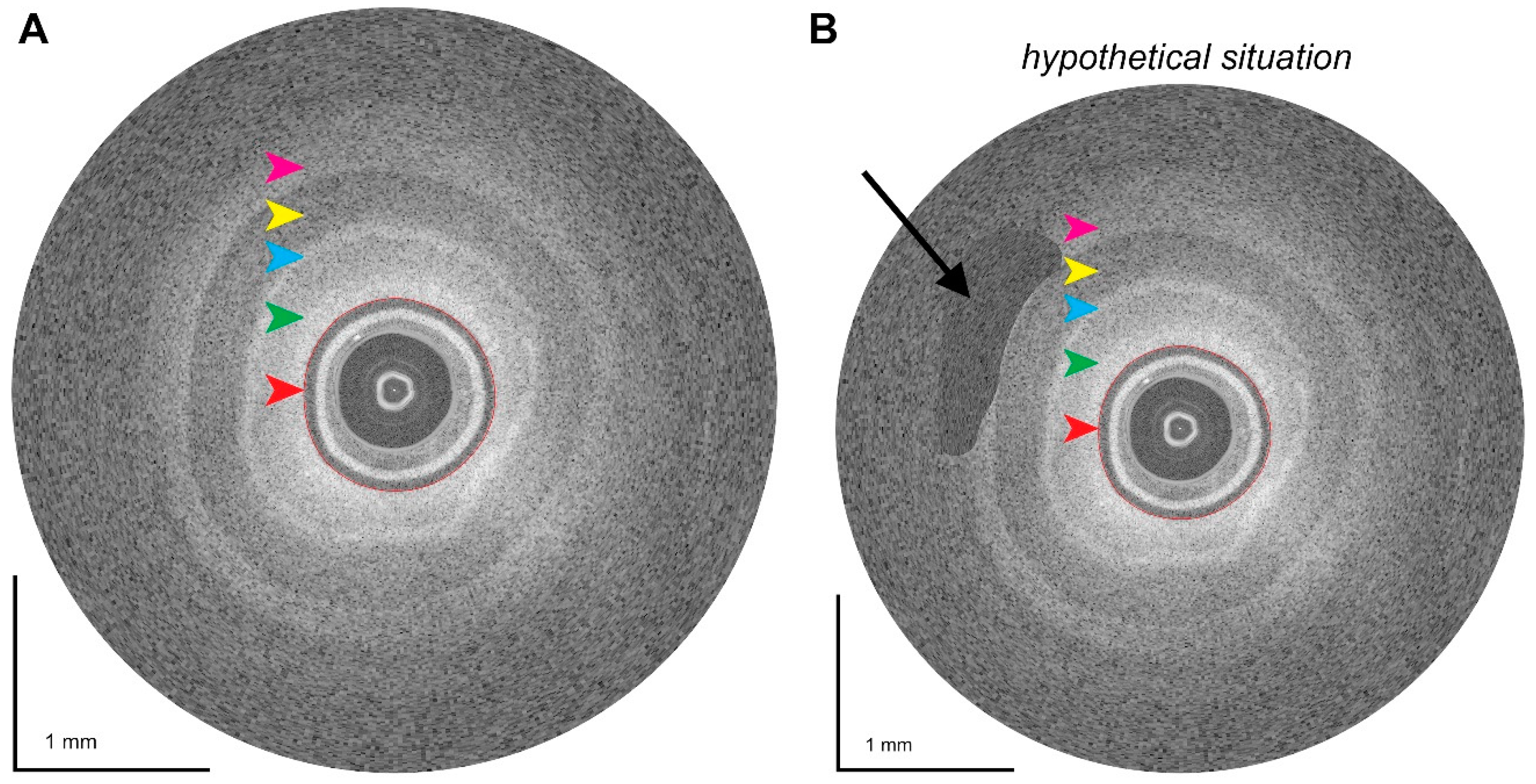 Cancers 16 03803 g003